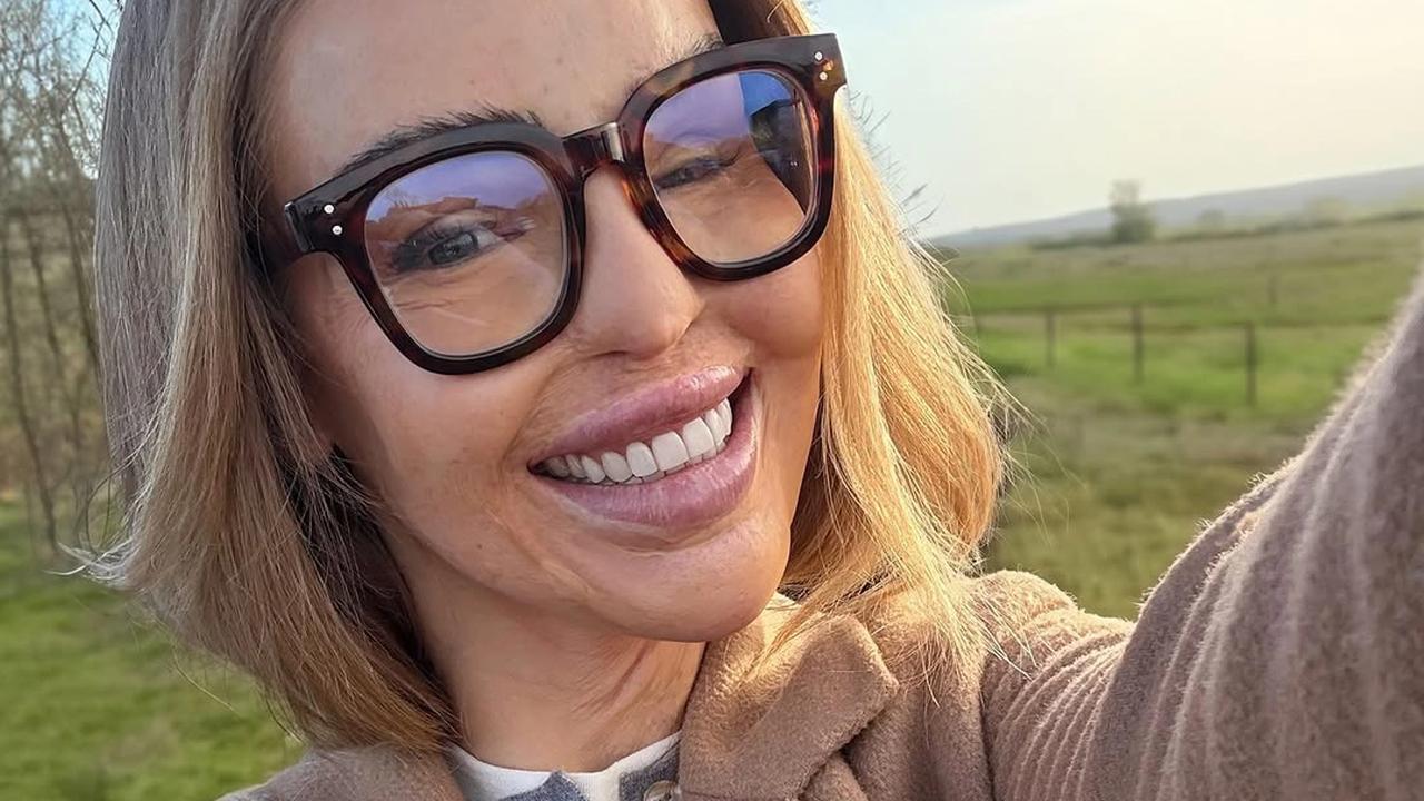 Katie Piper sa nevzdala a je veľkou inšpiráciou.