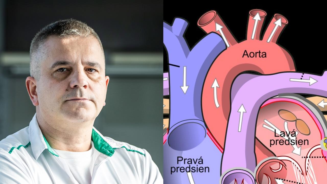 Docent Adrian Kolesár, prednosta Kliniky srdcovej chirurgie patrí k svetovej špičke.
