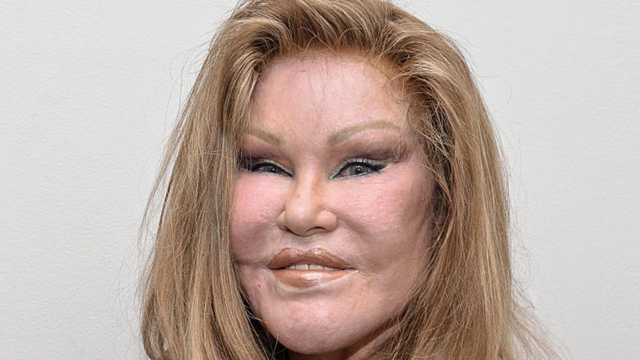 Jocelyn Wildenstein