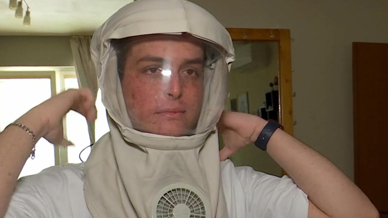 Tomáš z obce Obid neďaleko Štúrova trpí vzácnym ochorením, ktoré spôsobuje, že akýkoľvek kontakt s UV žiarením by pre neho mohol byť smrteľný.