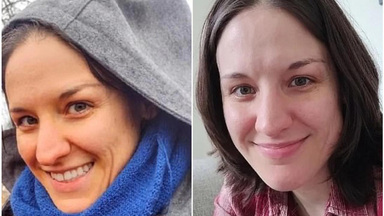 Ženina pokožka sa v dôsledku nadmernej konzumácie mrkvy sfarbila do oranžova.