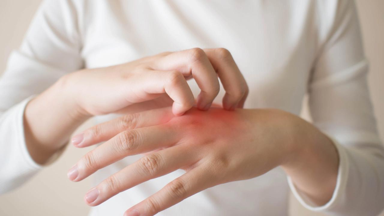 Za extrémne vysušenou pokožkou rúk sa môže skrývať aj atopický ekzém alebo psoriáza. Ak sa pokožka dlhodobo šúpe, objavil sa na nej mokvajúce rany alebo pľuzgiere, prípade je extrémne začervenaná, určite sa obráťte na dermatológa. Na rukách sa môže objaviť aj kontaktná alergia, vtedy sú potrebné testy, prípadne musíte odsledovať, kedy sa stav pokožky zhoršil.