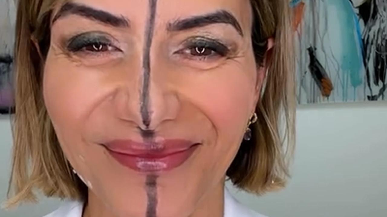 Dr. Farrellová ponúkla divákom názornú ukážku toho, čo s tvárou urobí výplň botoxom.