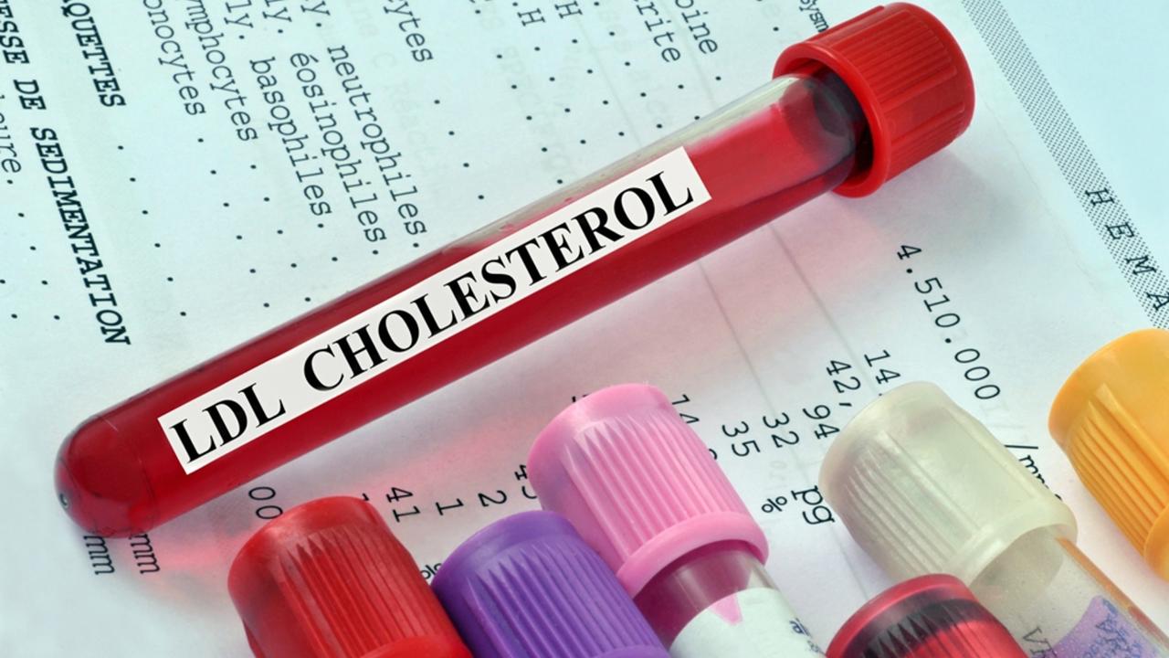 Nulový cholesterol by mal byť práve "zlý" LDL cholesterol, nie "dobrý" HDL cholesterol.