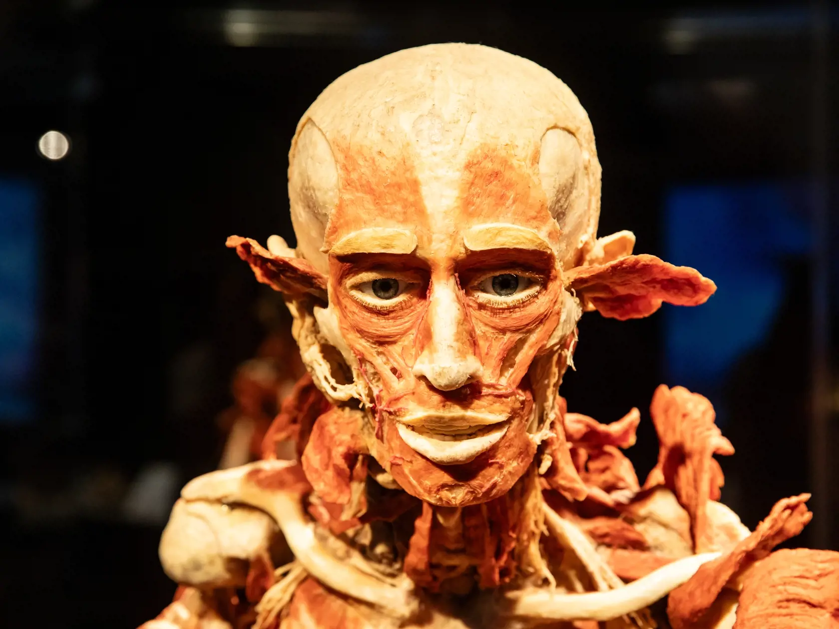 V piatok 13.10. začala v bratislavskom  nákupnom centre Nivy podľa viacerých odborníkov a mimovládnych organizácii kontroverzná výstava Body Worlds.