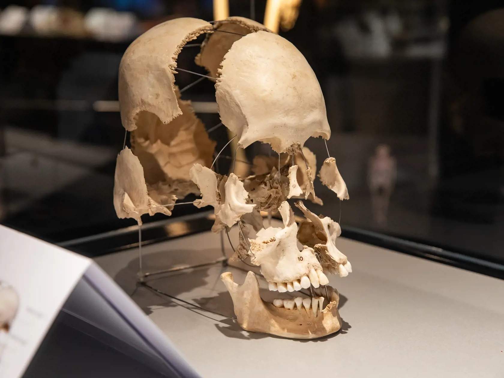 V piatok 13.10. začala v bratislavskom  nákupnom centre Nivy podľa viacerých odborníkov a mimovládnych organizácii kontroverzná výstava Body Worlds.