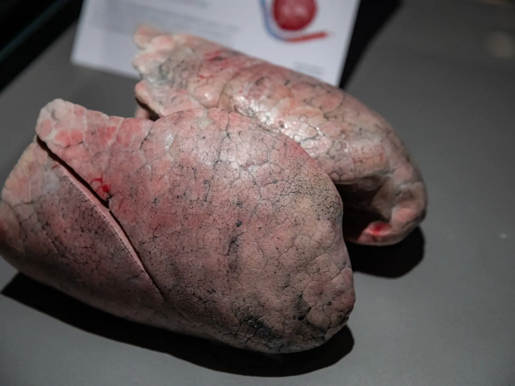 V piatok 13.10. začala v bratislavskom  nákupnom centre Nivy podľa viacerých odborníkov a mimovládnych organizácii kontroverzná výstava Body Worlds.