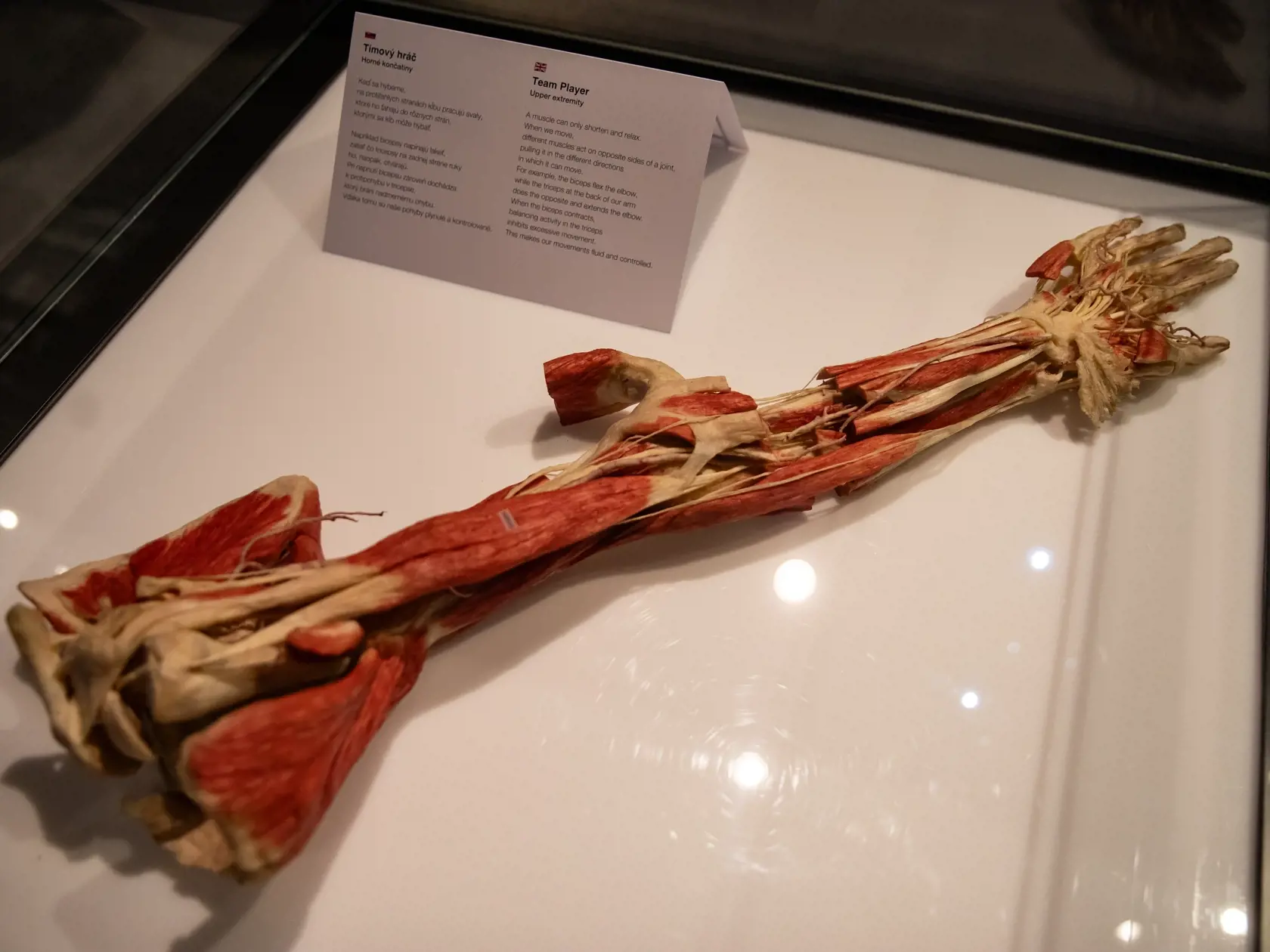 V piatok 13.10. začala v bratislavskom  nákupnom centre Nivy podľa viacerých odborníkov a mimovládnych organizácii kontroverzná výstava Body Worlds.