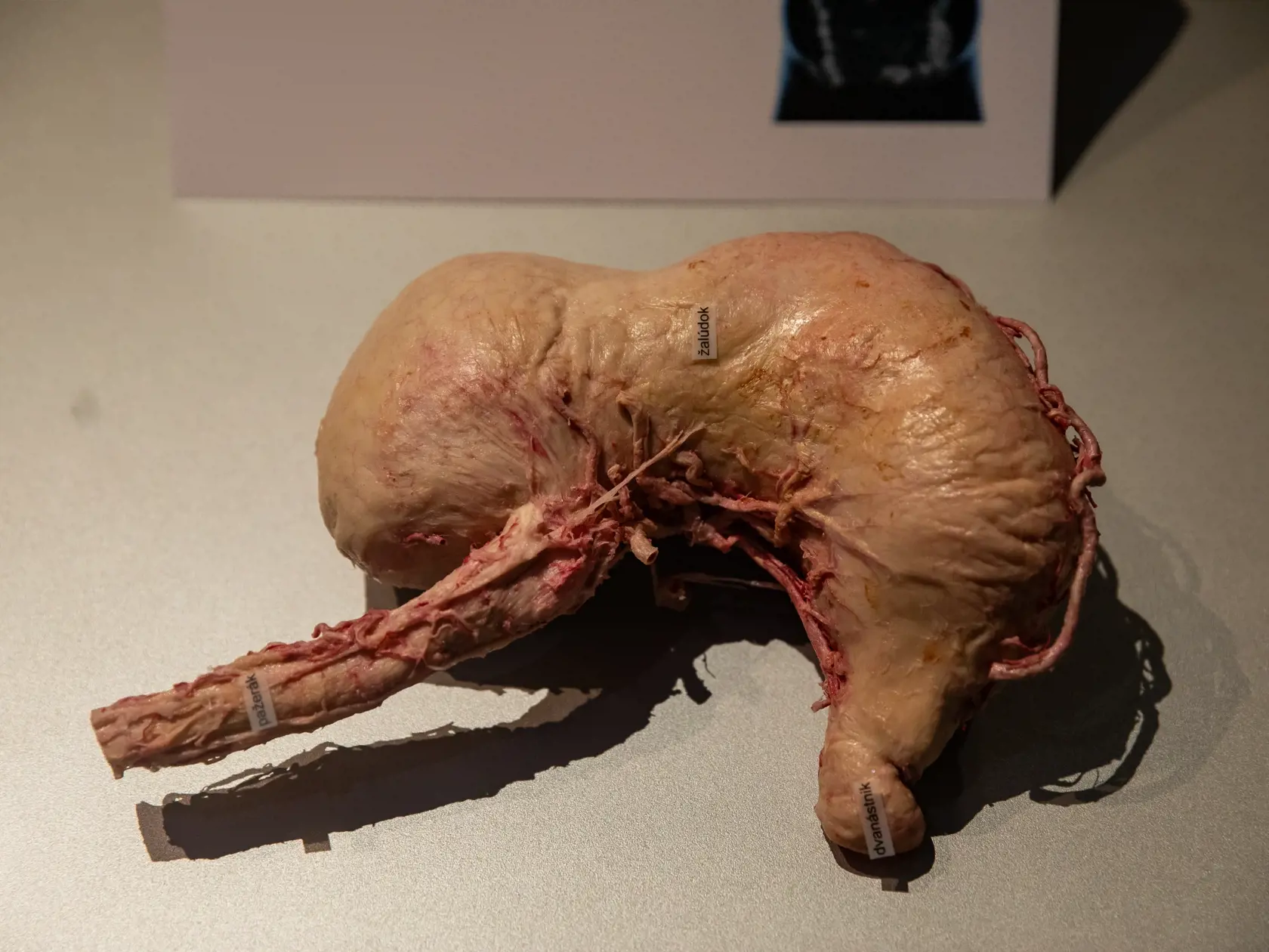 V piatok 13.10. začala v bratislavskom  nákupnom centre Nivy podľa viacerých odborníkov a mimovládnych organizácii kontroverzná výstava Body Worlds.