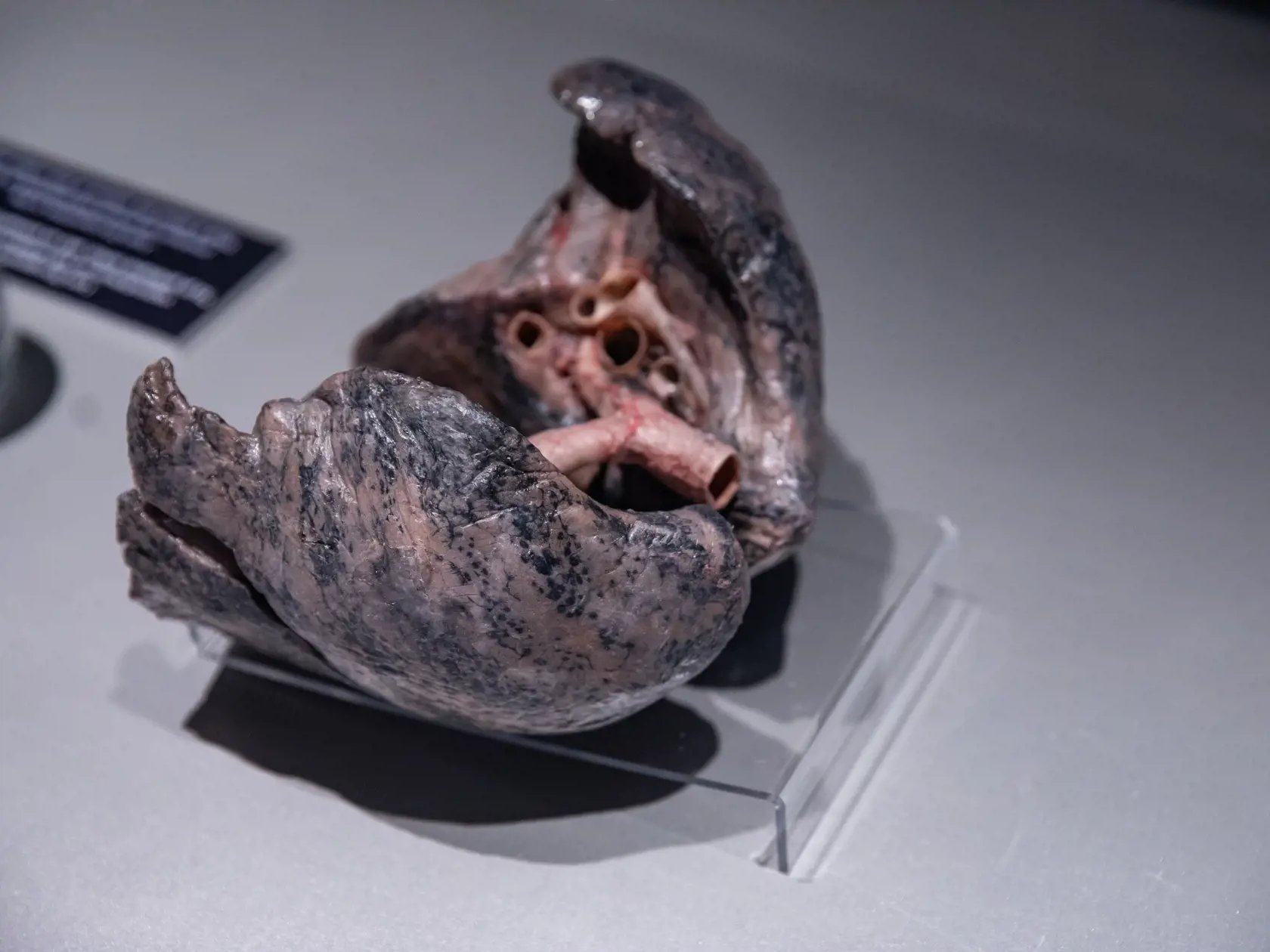 V piatok 13.10. začala v bratislavskom  nákupnom centre Nivy podľa viacerých odborníkov a mimovládnych organizácii kontroverzná výstava Body Worlds.
