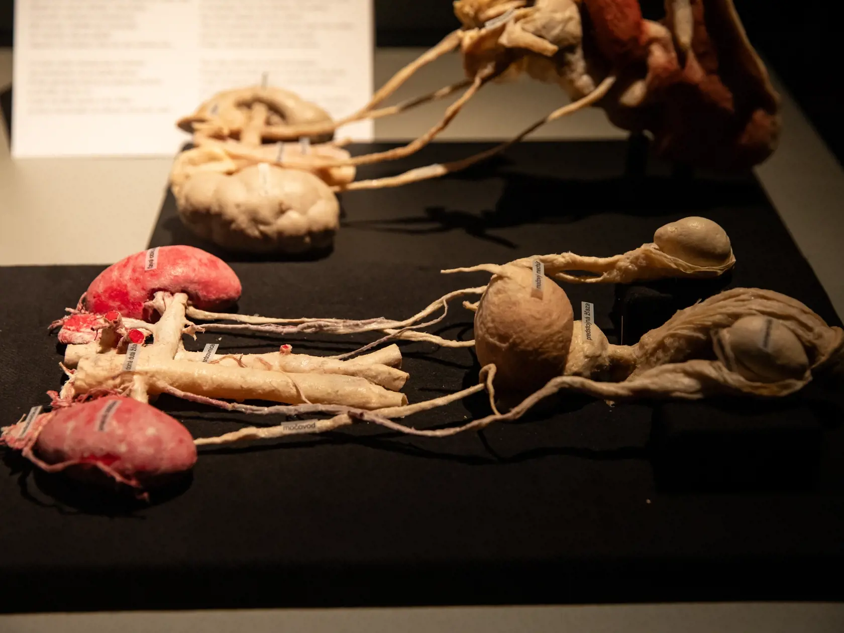 V piatok 13.10. začala v bratislavskom  nákupnom centre Nivy podľa viacerých odborníkov a mimovládnych organizácii kontroverzná výstava Body Worlds.
