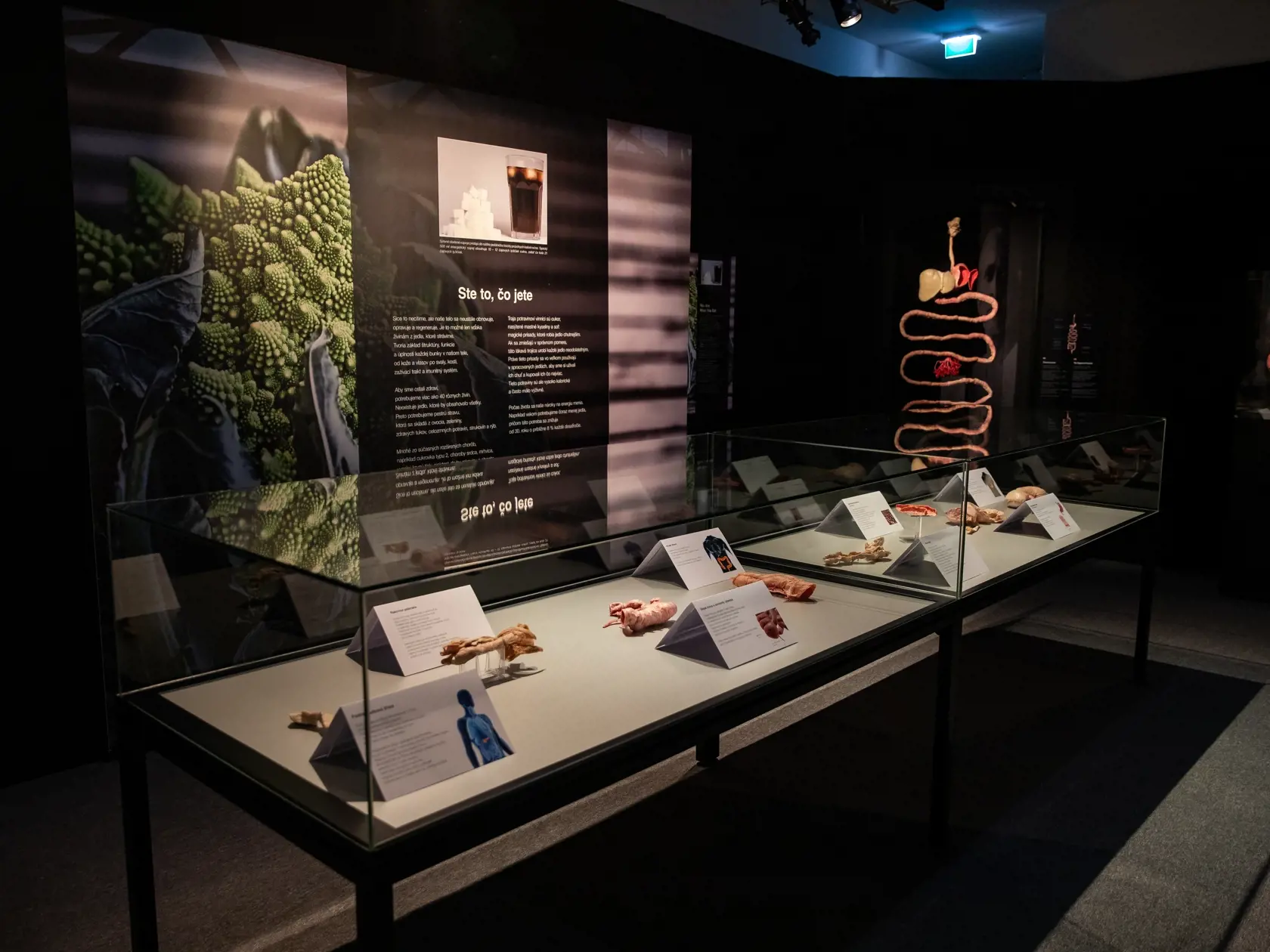 V piatok 13.10. začala v bratislavskom  nákupnom centre Nivy podľa viacerých odborníkov a mimovládnych organizácii kontroverzná výstava Body Worlds.