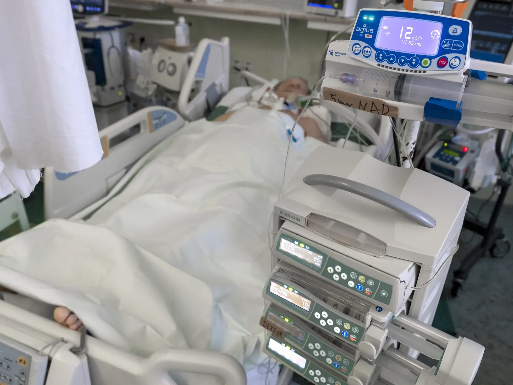 Situácia na anesteziologicko-resuscitačnom oddelení nemocnice svätého Cyrila a Metoda v Bratislave si vyžiadala zriadenie špeciálnej sekcie, kde sa nepretržite starajú o pacientov nakazených koronavírusom Covid - 19. 
