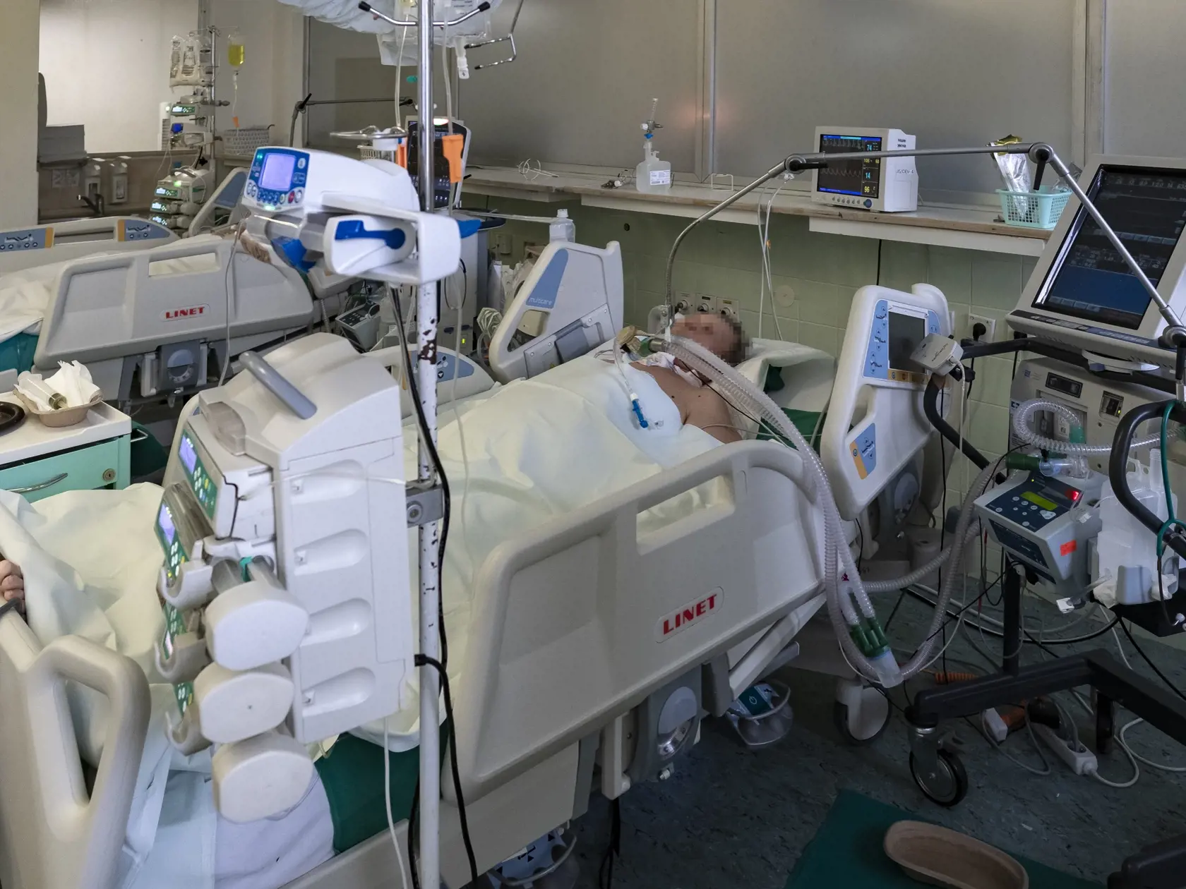 Situácia na anesteziologicko-resuscitačnom oddelení nemocnice svätého Cyrila a Metoda v Bratislave si vyžiadala zriadenie špeciálnej sekcie, kde sa nepretržite starajú o pacientov nakazených koronavírusom Covid - 19. 
