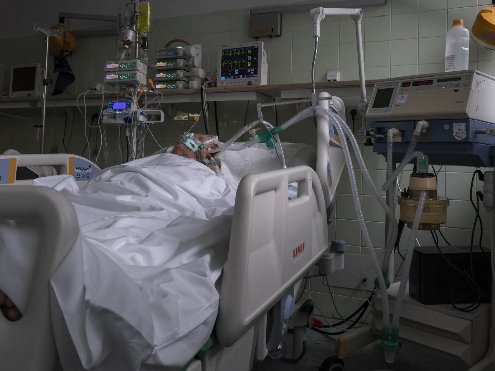 Situácia na anesteziologicko-resuscitačnom oddelení nemocnice svätého Cyrila a Metoda v Bratislave si vyžiadala zriadenie špeciálnej sekcie, kde sa nepretržite starajú o pacientov nakazených koronavírusom Covid - 19. 