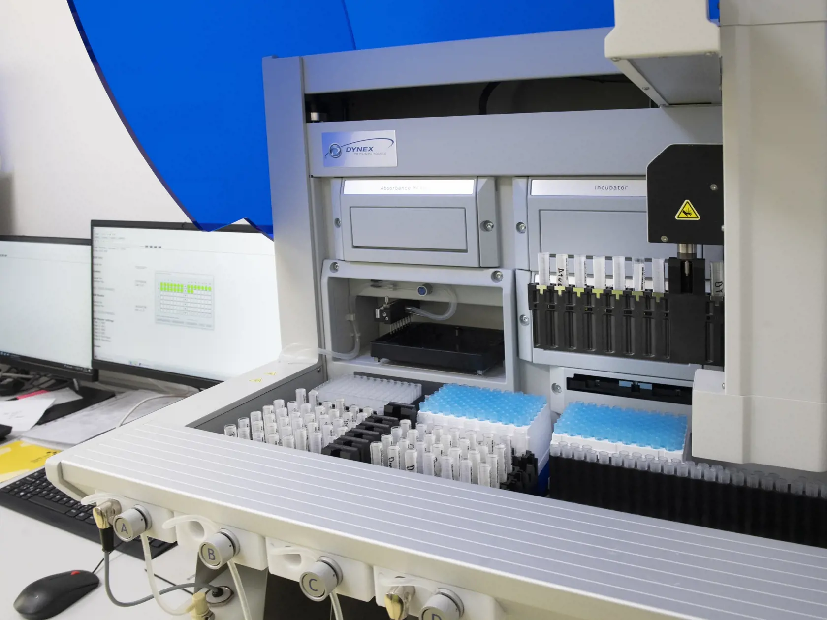 Na snímke laboratórium s prístrojom na zistenie protilátok po prekonaní ochorenia COVID-19 analytickou metódou elisa v priestoroch laboratórnej a diagnostickej spoločnosti Unilabs Slovensko v Bratsialave v pondelok 31. januára 2022. FOTO TASR - Pavel Neubauer