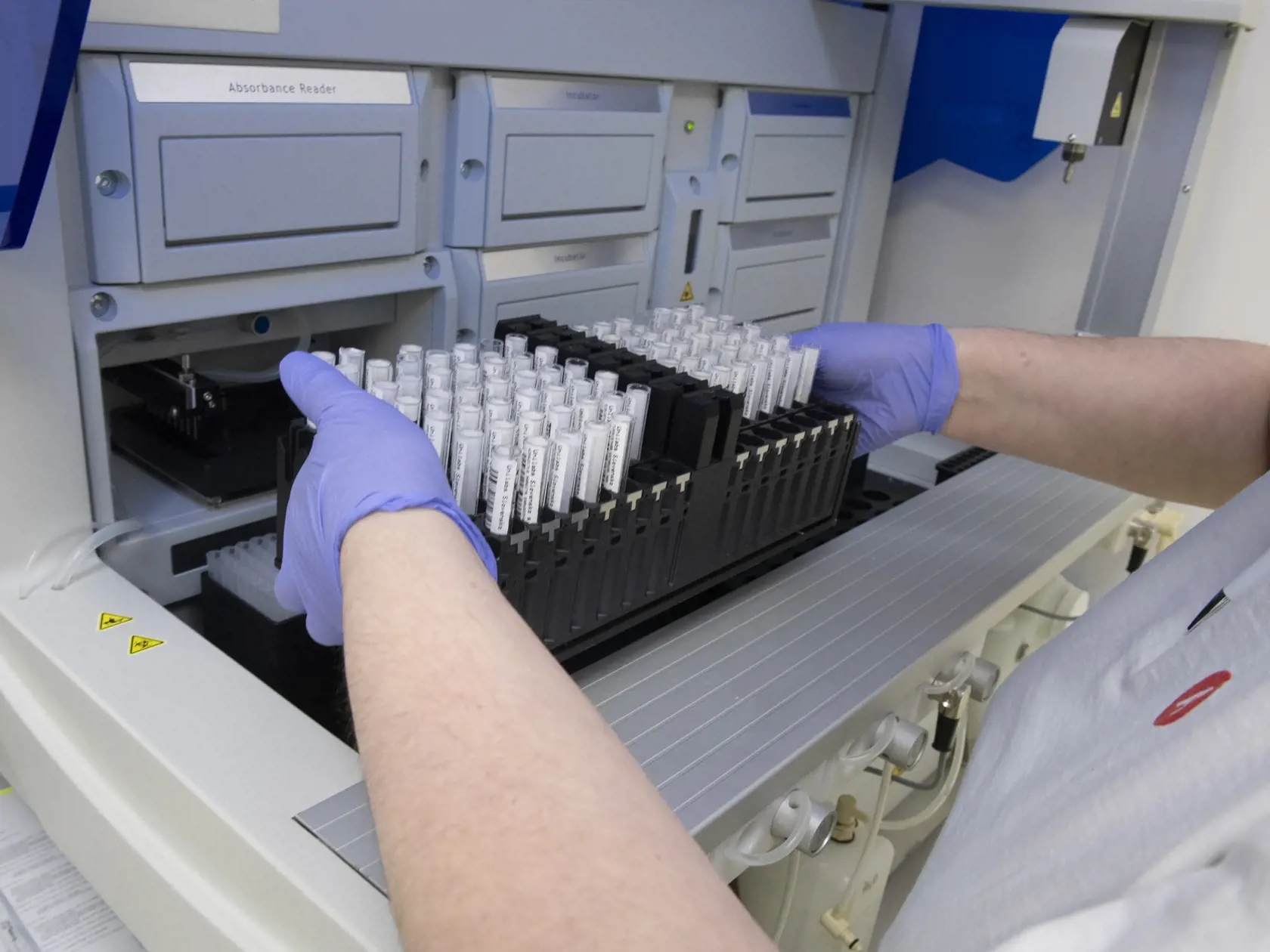 Na snímke prístroj, do ktorého laborantka ukladá vzorky na zistenie protilátok po prekonaní ochorenia COVID-19 analytickou metódou elisa v priestoroch laboratórnej a diagnostickej spoločnosti Unilabs Slovensko v Bratsialave v pondelok 31. januára 2022. FOTO TASR - Pavel Neubauer