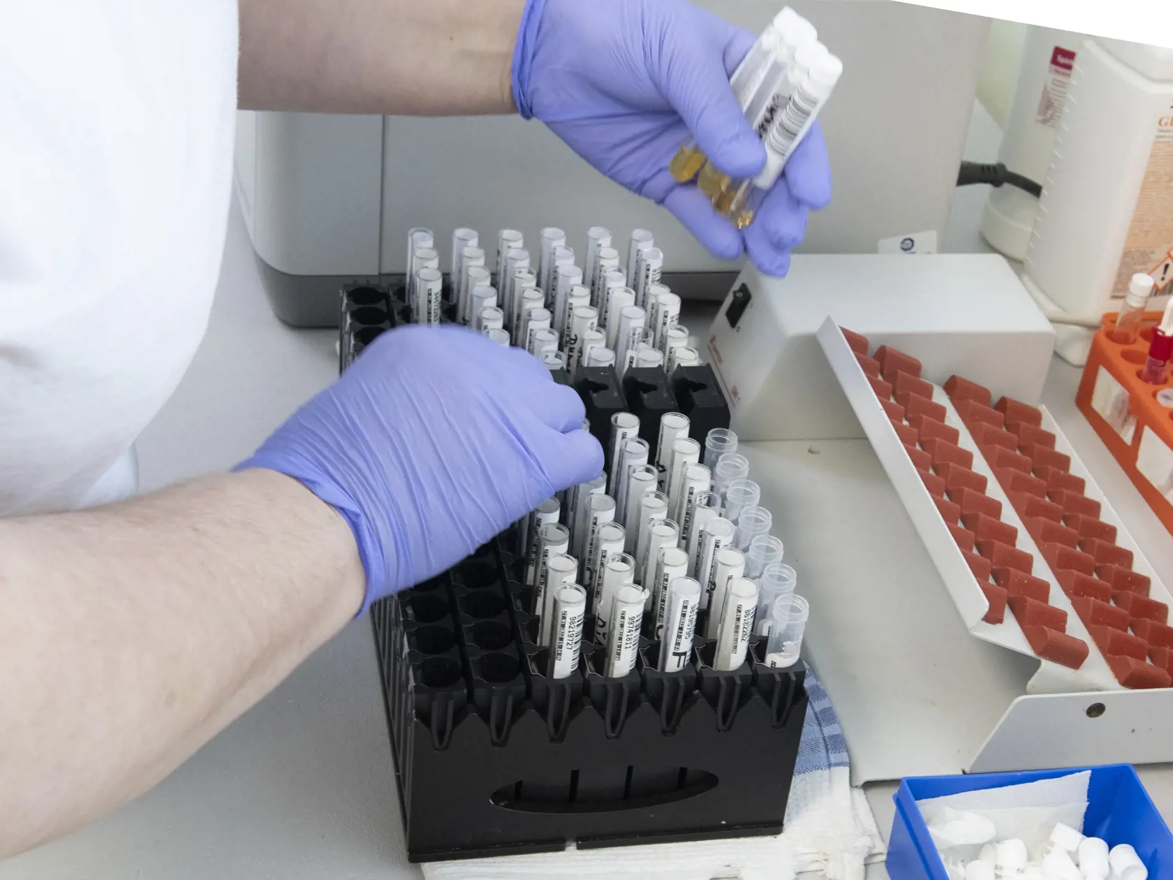 Na snímke ukladanie vzoriek pred vyšetrením protilátok po prekonaní ochorenia COVID-19 analytickou metódou elisa v priestoroch laboratórnej a diagnostickej spoločnosti Unilabs Slovensko v Bratsialave v pondelok 31. januára 2022. FOTO TASR - Pavel Neubauer