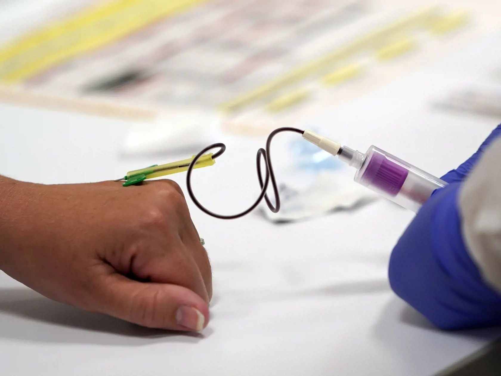 Existujú dve metódy testovania. Vykonávajú sa buď tzv. PCR testy (výter z nosohltana), ktorými sa zistí, či aktuálne máte koronavírus, alebo test protilátok metódou Elisa (odber krvi zo žily), kde sa skúma, či ste nákazu prekonali.