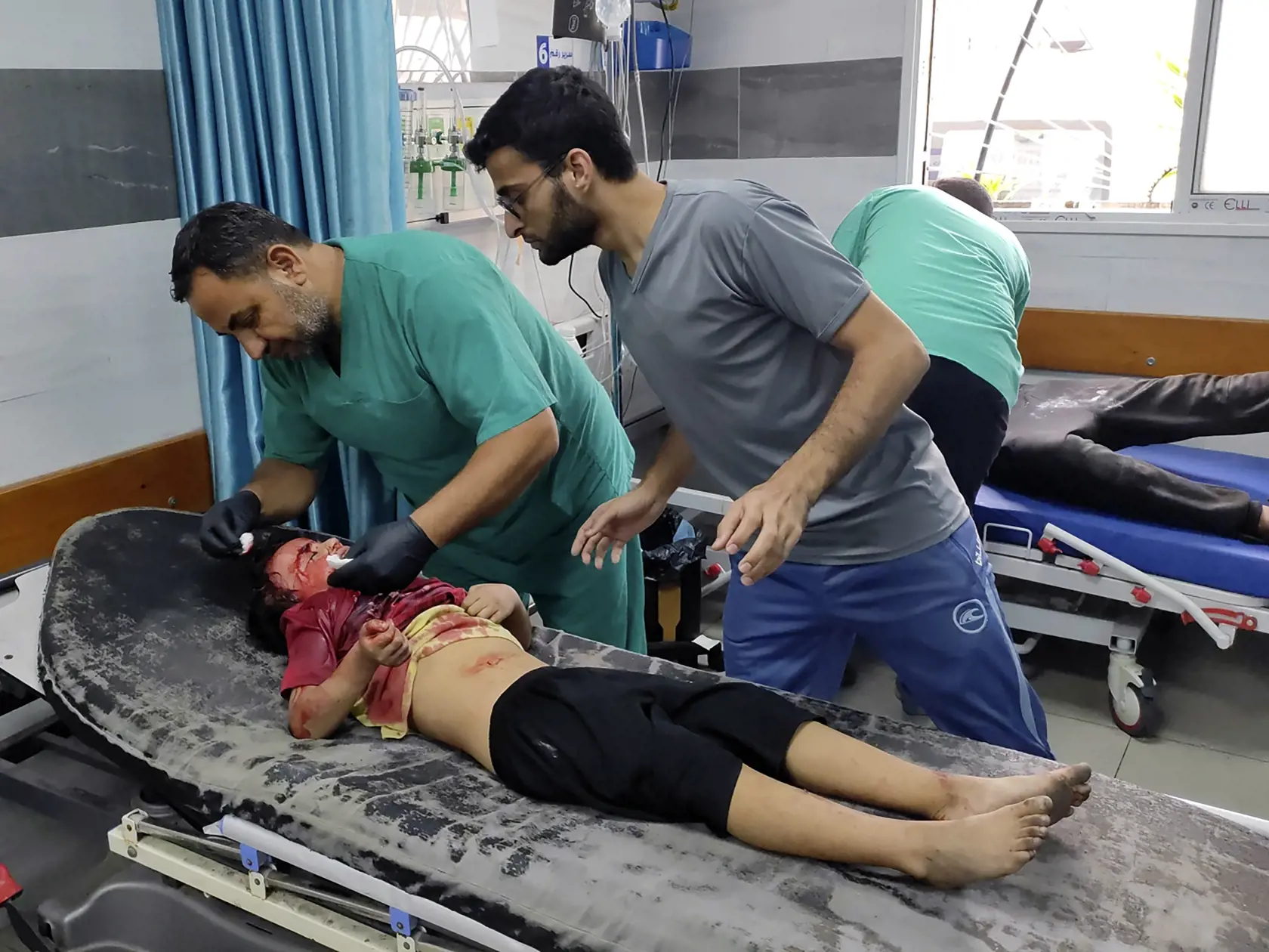 Zdravotníci ošetrujú zranené palestínske dievča po izraelskom bombardovaní pásma Gazy v nemocnici Kama Adwan v palestínskom meste Jabaliya na predmestí Gazy 2. novembra 2023.