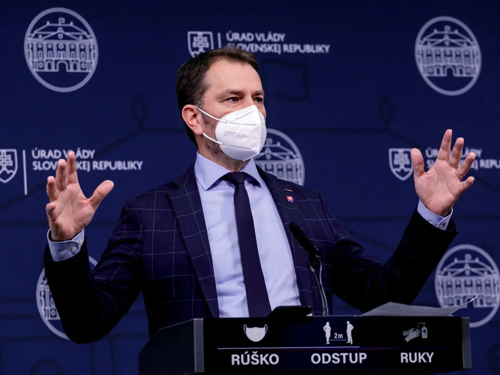 Minister financií Igor Matovič sa na sociálnej sieti "pochválil", že sa omylom umyl šampónom svojho kocúra.