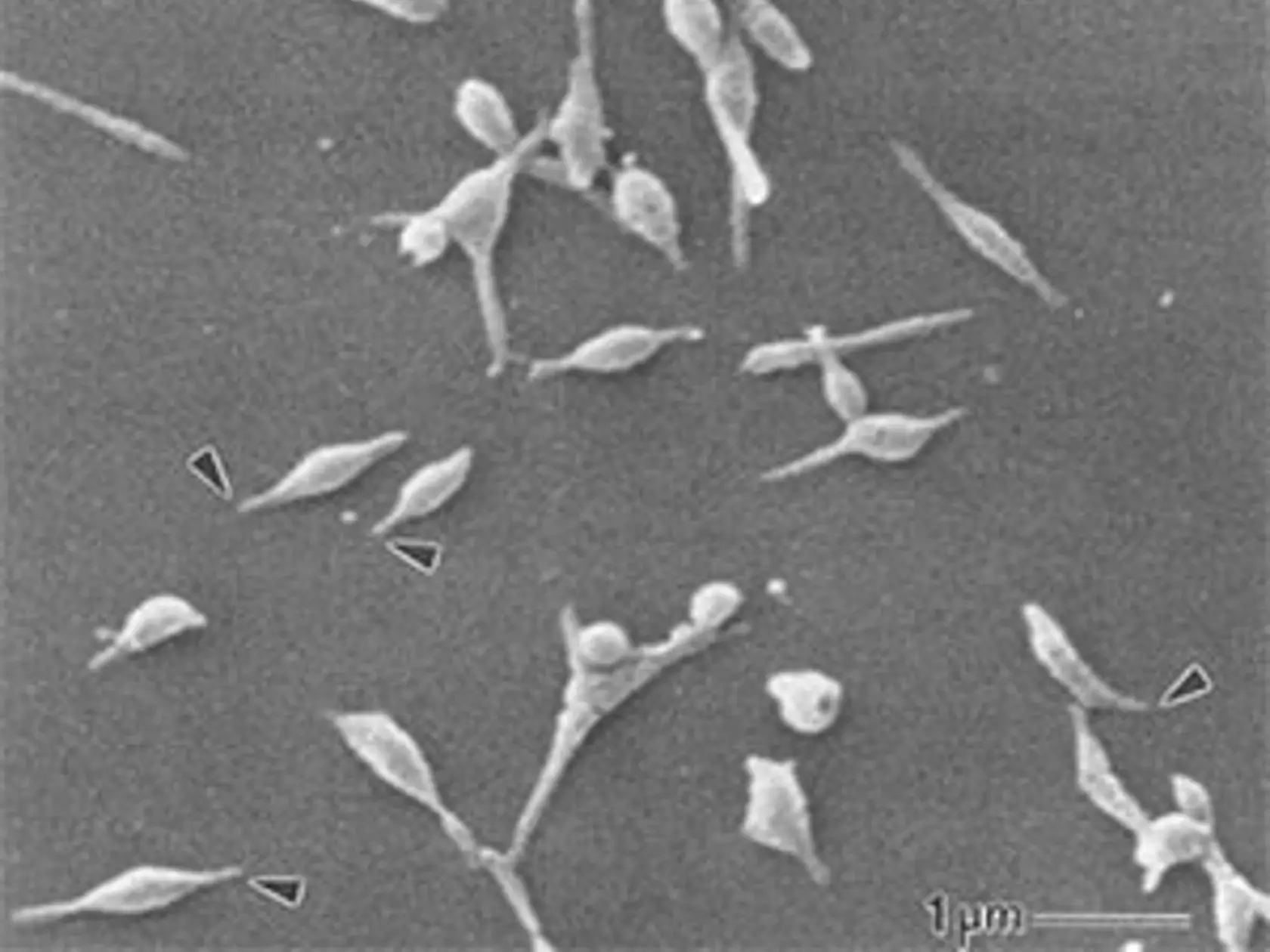 Baktéria Mycoplasma mneumoniae