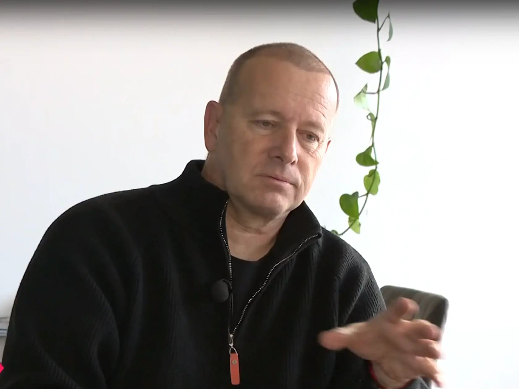Cena zákroku v Turecku je podstatne nižšia než v západnej Európe, čo pre Borisa Kollára bolo ďalším lákavým faktorom.