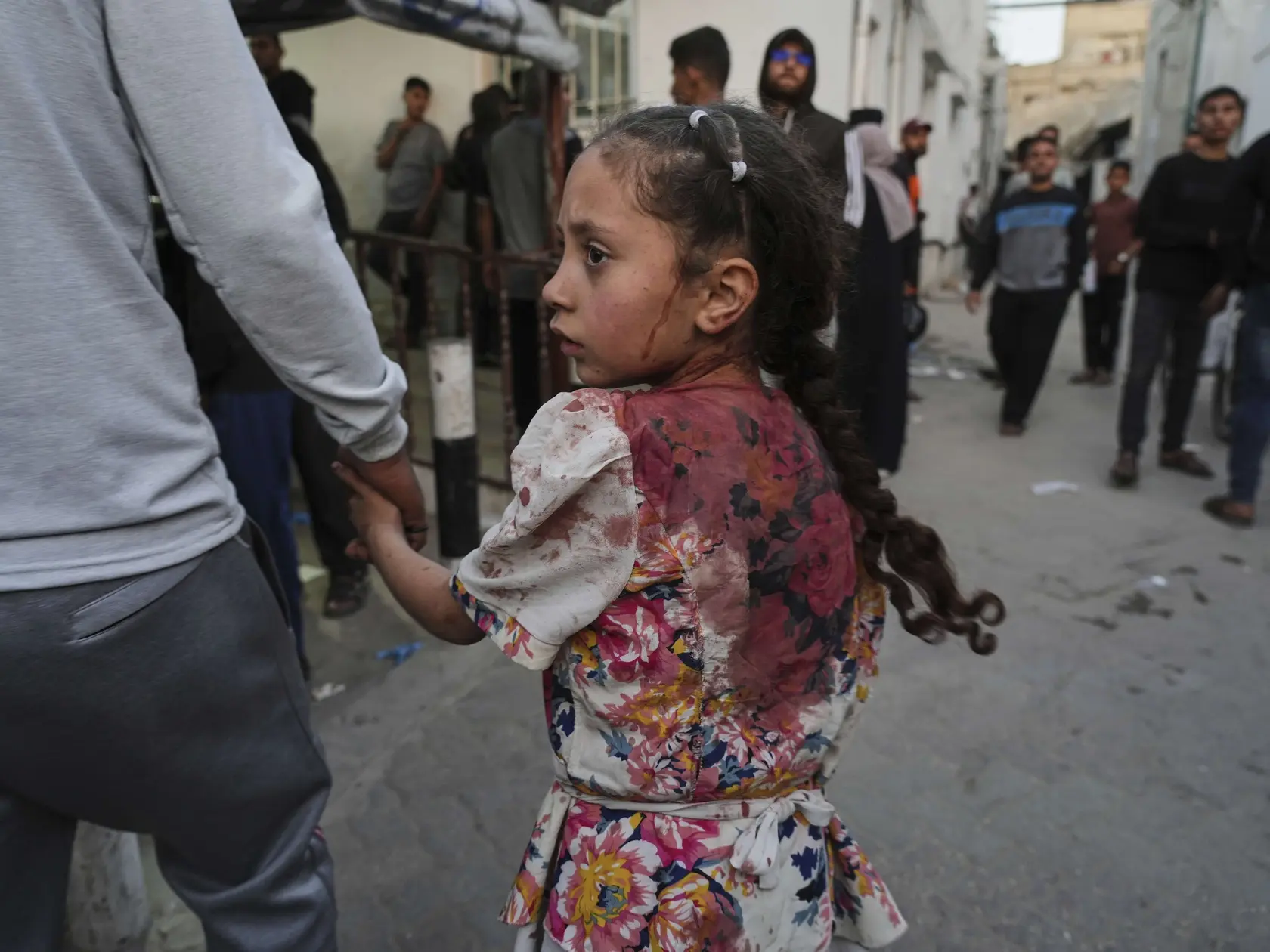 JB 32 Gaza - Palestínske dievčatko zranené po izraelských leteckých útokoch prinášajú na ošetrenie do nemocnice v meste Gaza 3. apríla 2025. Najmenej 25 ľudí prišlo v Pásme Gazy vo štvrtok o život pri izraelskom leteckom útoku na budovu školy, ktorá slúži ako útočisko pre ľudí vysídlených v dôsledku vojny, uviedla tamojšia civilná obrana. TASR informuje podľa agentúry AFP. Podľa hovorcu gazského úradu pre civilnú obranu Mahmúda Bassala došlo k náletu severovýchodne od mesta Gaza a zranenia utrpelo najmenej ďalších 100 osôb. FOTO TASR/AP

A young Palestinian girl who was injured in an Israeli airstrike, is brought for a treatment at the Baptist Hospital in Gaza City, on Thursday, April 3, 2025. (AP Photo/Jehad Alshrafi)