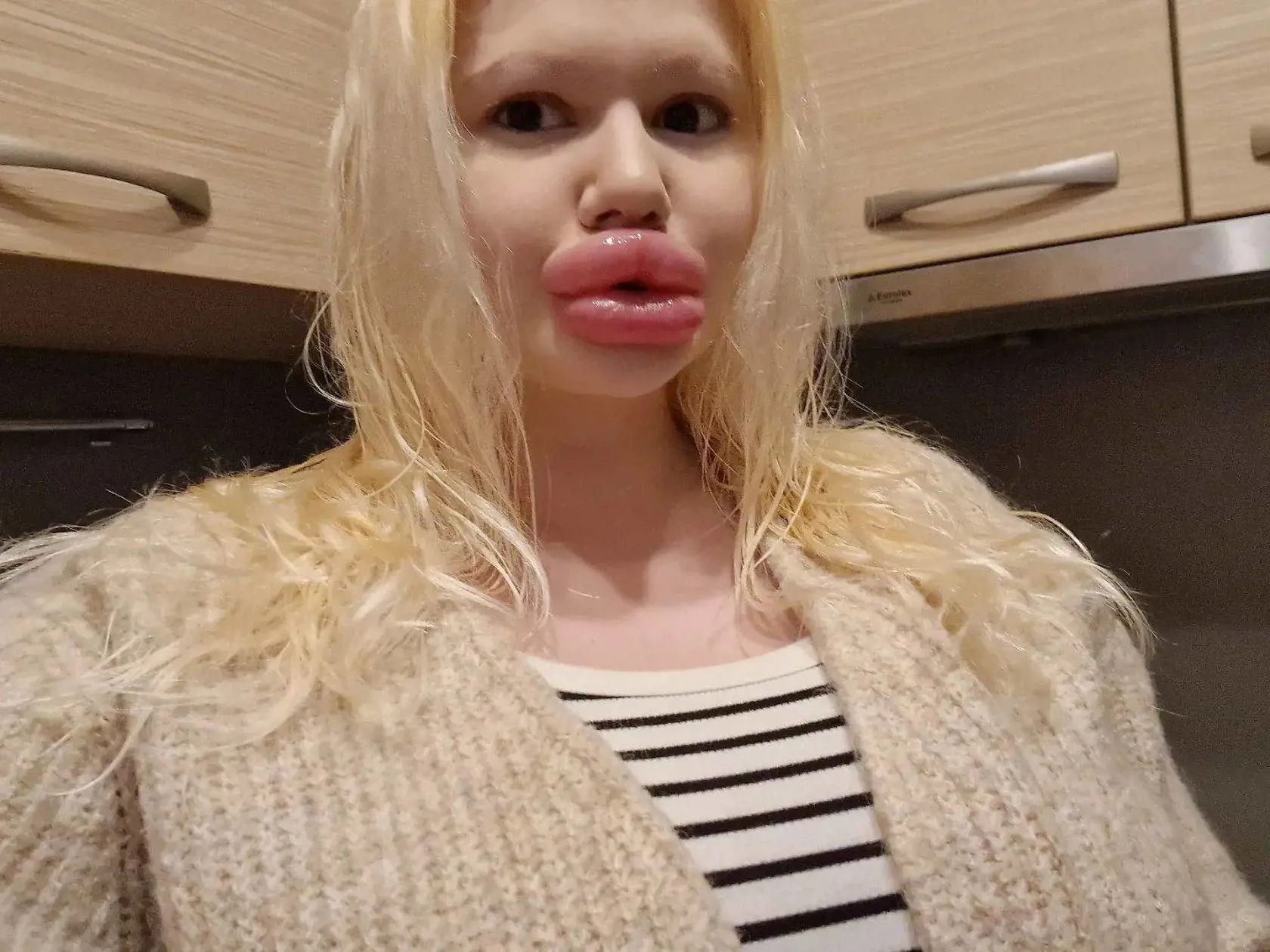 Andrea Ivanova a jej obrie ústa
