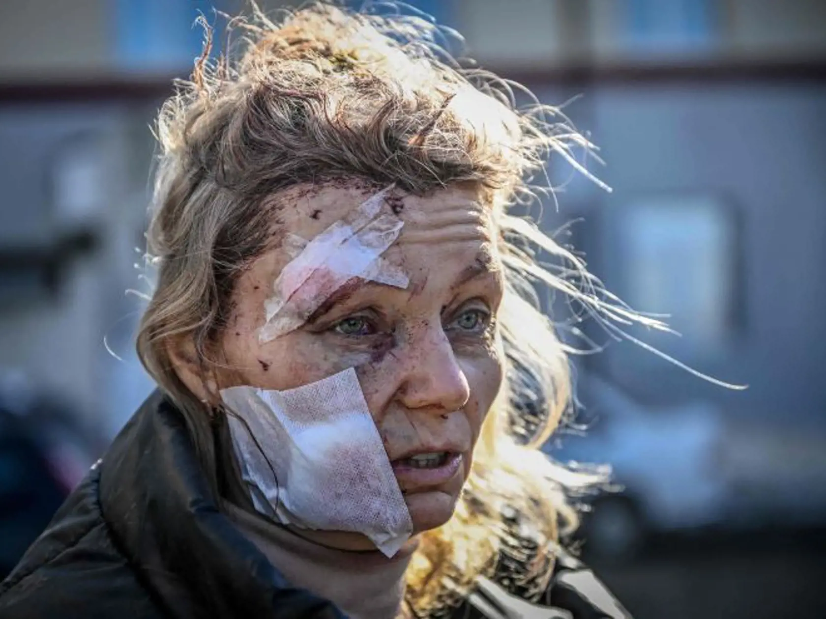 Olena Kurilo (52) po bombardovaní v Charkove.