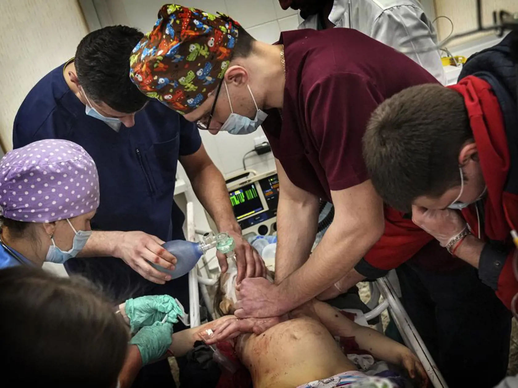 Dievčatko v snahe o záchranu jej života previezli zo sanitky dovnútra nemocnice. Okolo nej sa tlačili lekári a sestry. Jeden jej dal injekciu. Ďalší sa ju pokúsil oživiť pomocou defibrilátora. Sestra plakala. Doktor, ktorý do nej pumpoval kyslík, sa pozrel priamo do kamery video reportéra: „Ukážte to Putinovi,“ povedal nahnevane.
