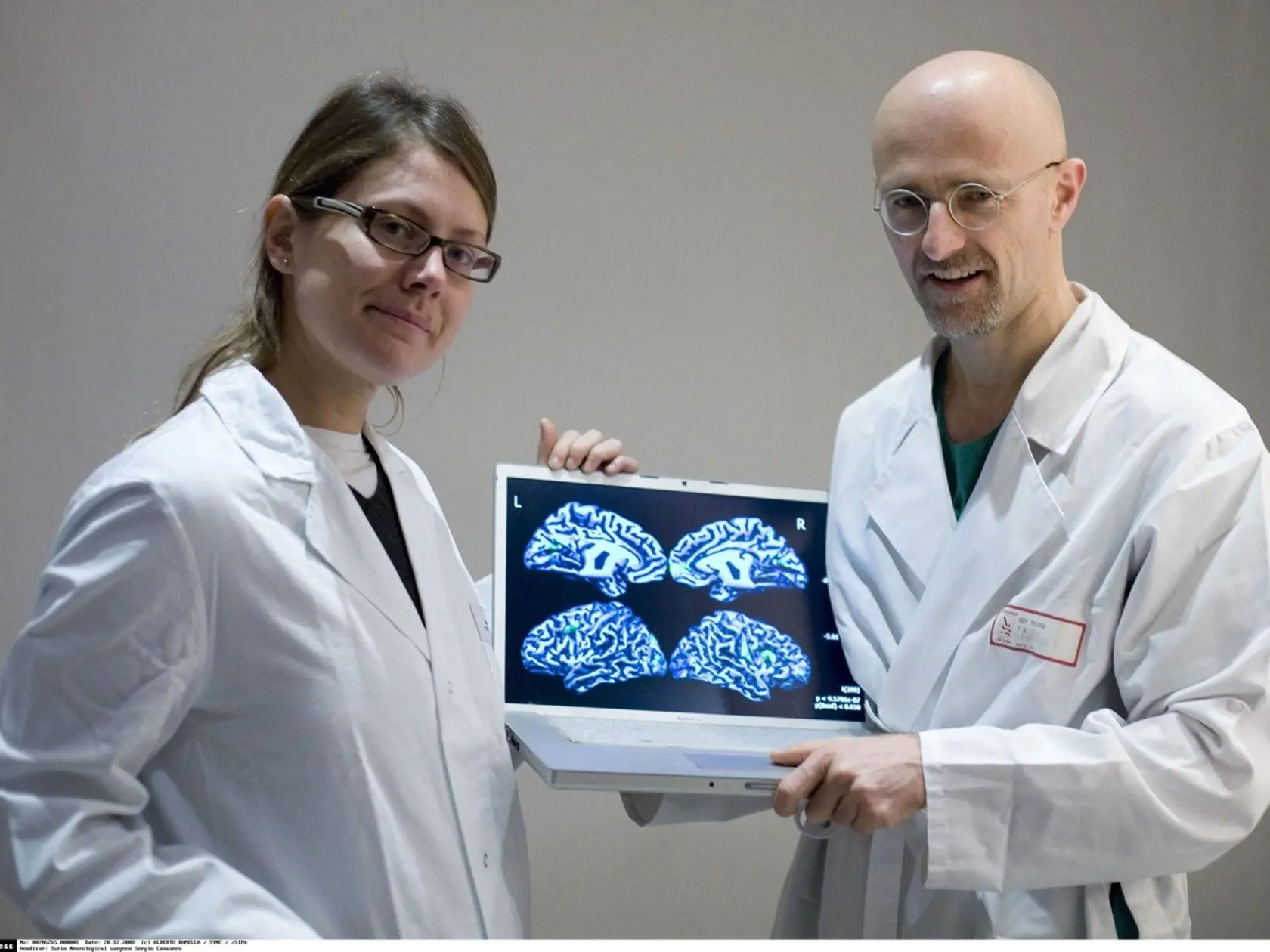 Vedci uskutočnili prvú transplantáciu ľudskej hlavy na mŕtvole.