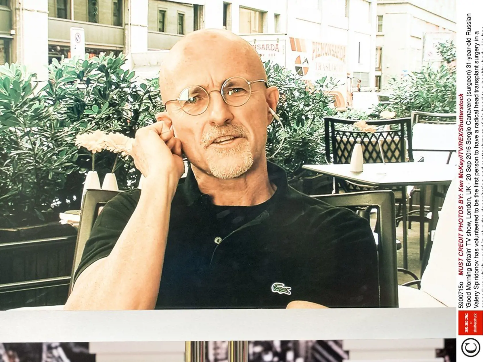 Kontroverzný taliansky profesor Sergio Canavero.