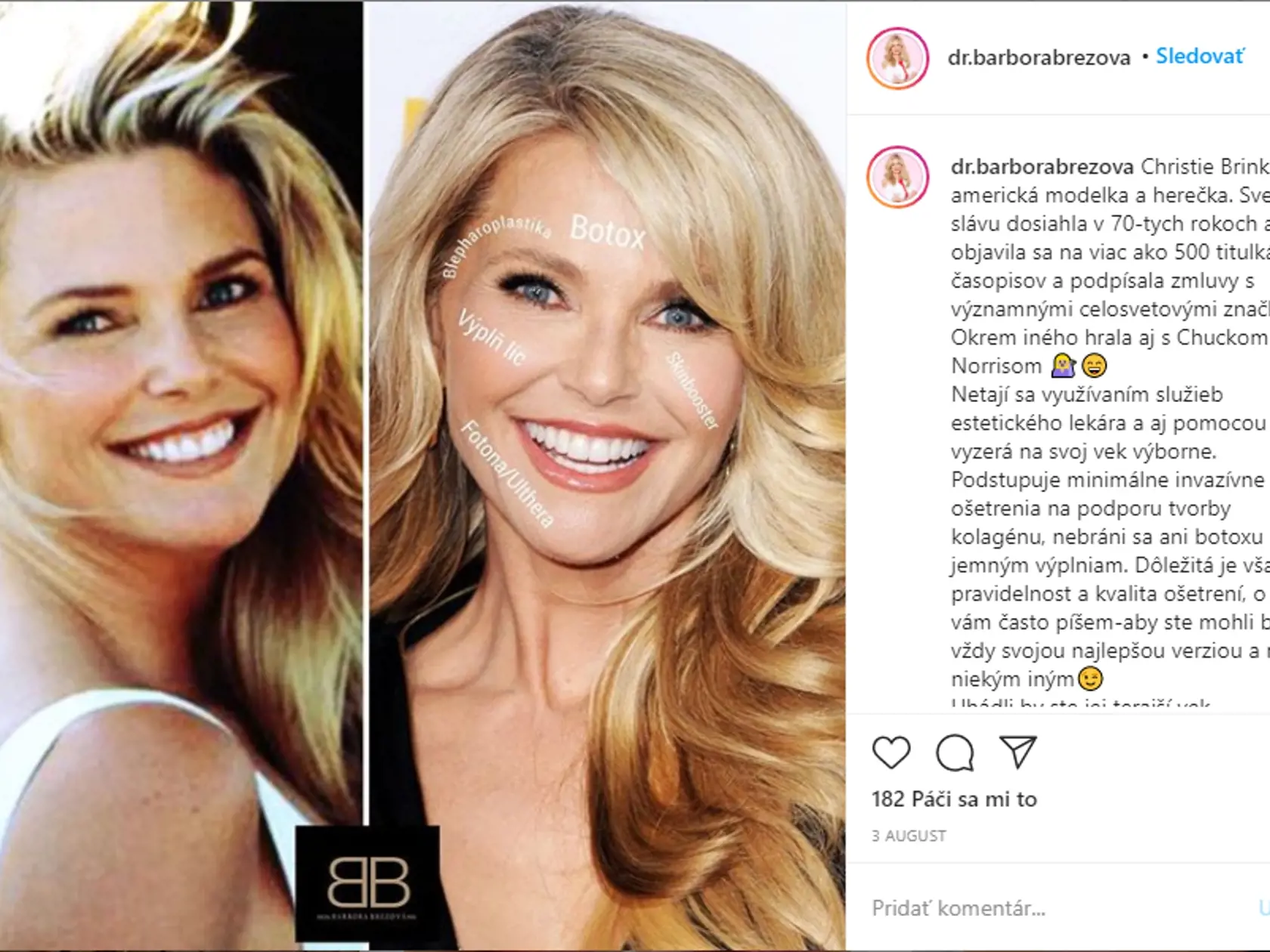 Christie Brinkley (66)