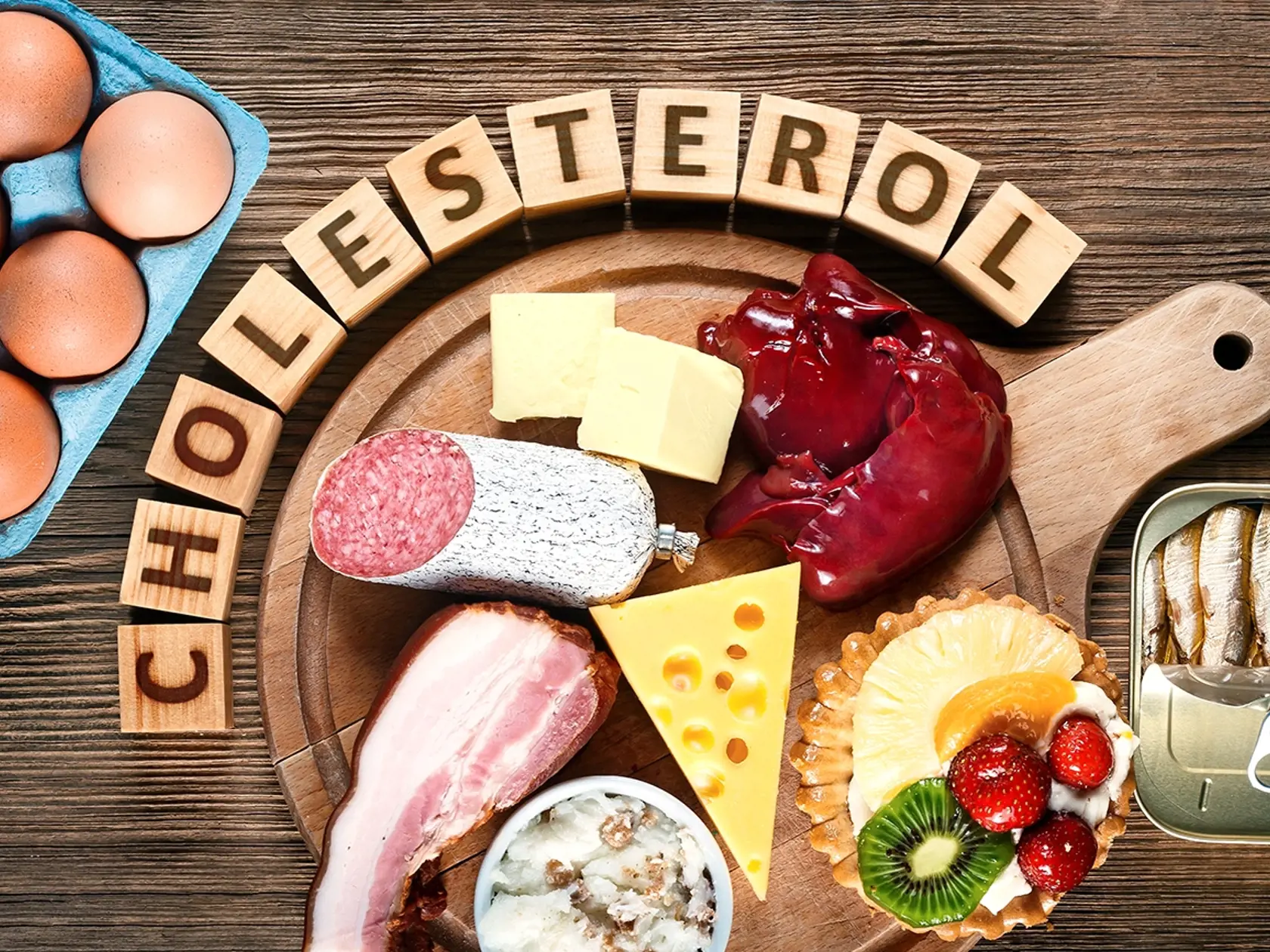 Cholesterol zvyšujú tučné jedlá.