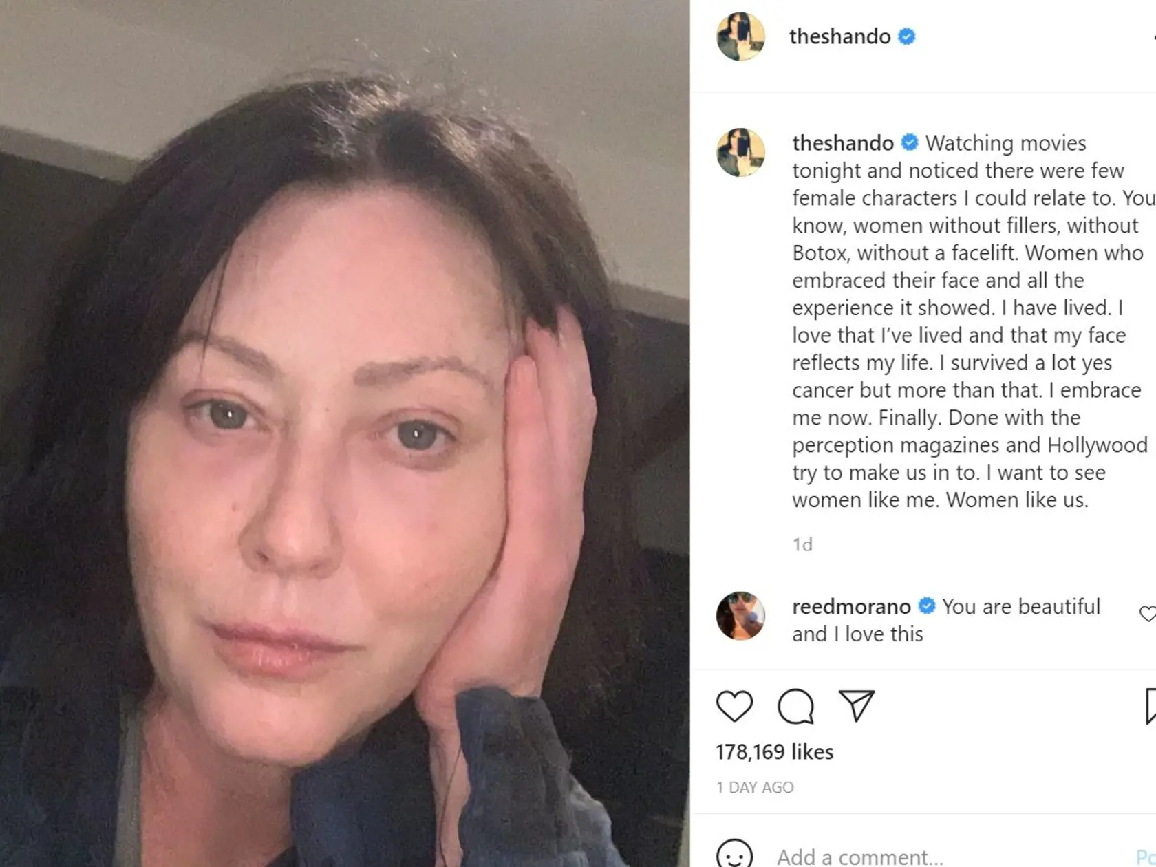 Herečka na sociálnej sieti instagram zverejnila svoju tvár bez mejkapu s dojemnými slovami o jej boji s rakovinou. S filmovými kráskami sa už stotožniť nedokáže.