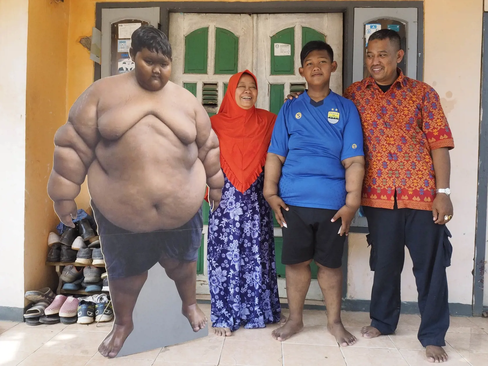 Fotografia PRED a PO. Arya Permana ( v modrom tričku) dnes váži 86 kilogramov.