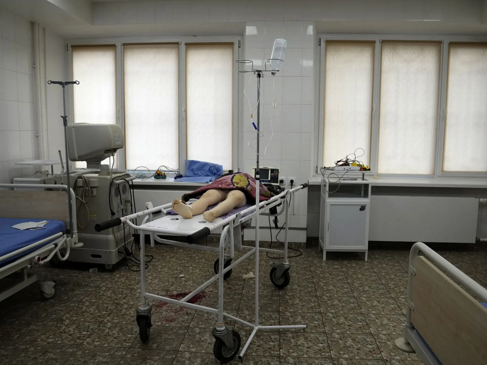 JB 28 Mariupol - Telo zabitého dievčatka počas ostreľovania obytnej oblasti leží na nemocničnom stole v nemocnici v meste Mariupol na východe Ukrajiny 27. februára 2022.