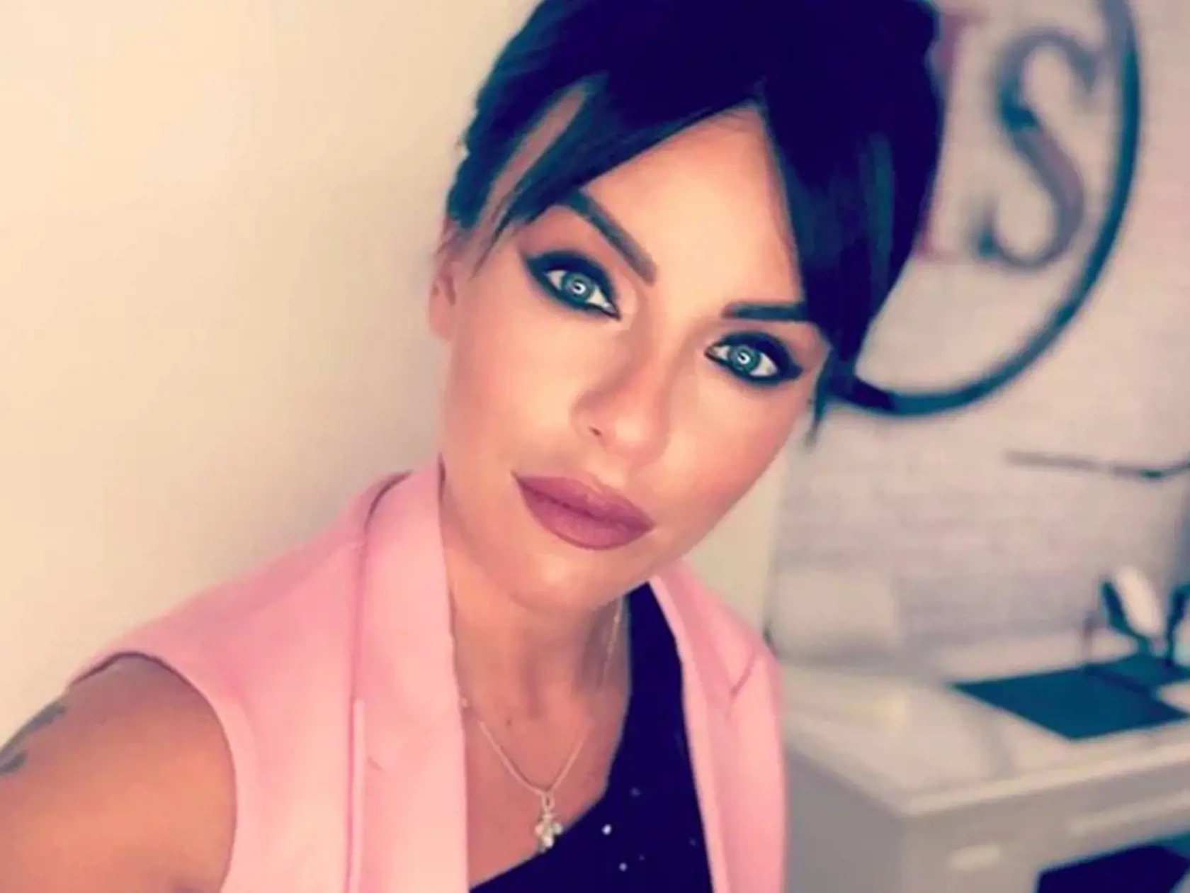 Julia Volkova vyzerá kvôli plastickým operáciám na nepoznanie.