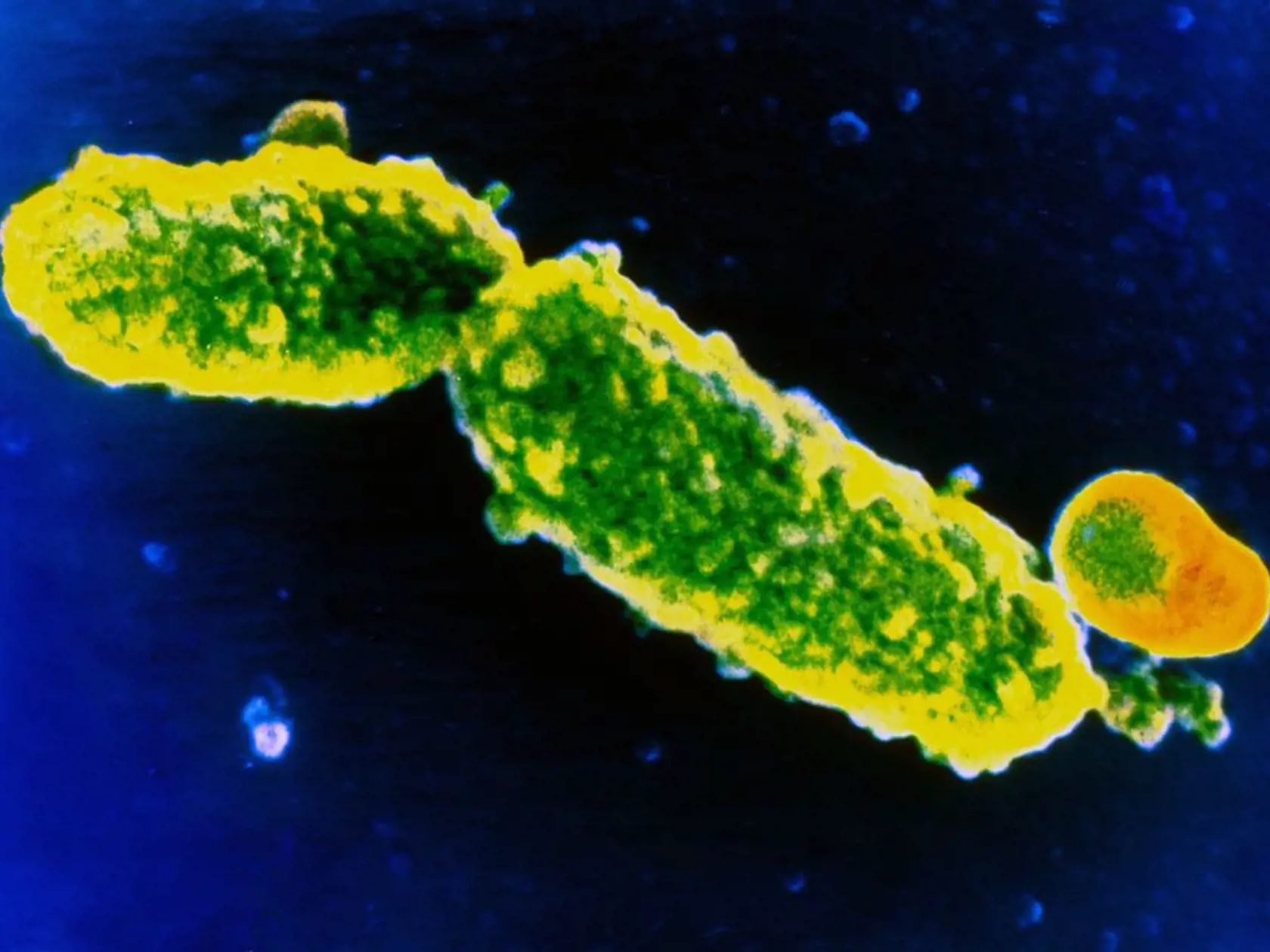 Baktéria Bordetella pertussis, ktorá čierny kašeľ spôsobuje.