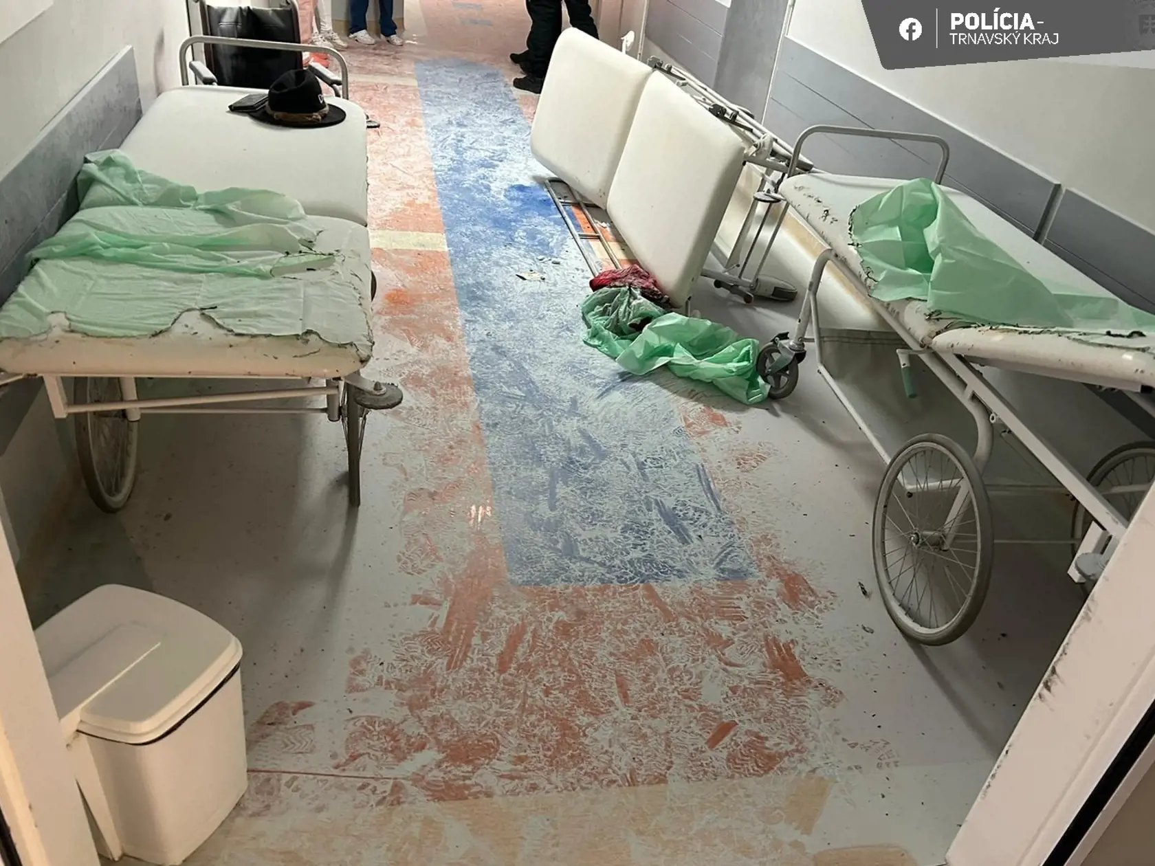 Agresívny muž na urgente v Trnave napadol sestru a podpáli lôžko.