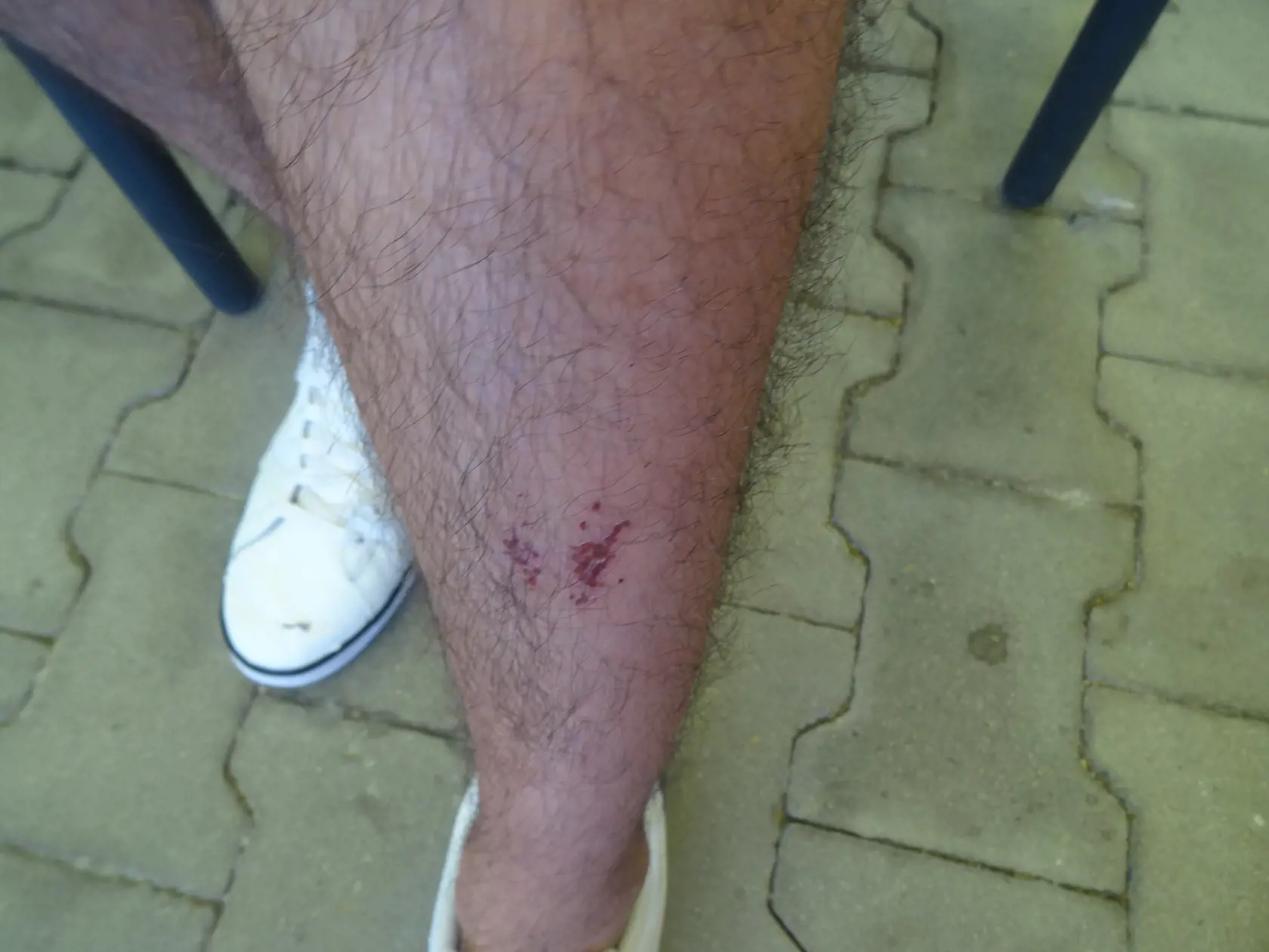 Učiteľ má aj po viac než dvoch týždňoch stále  doráňané obidve nohy.