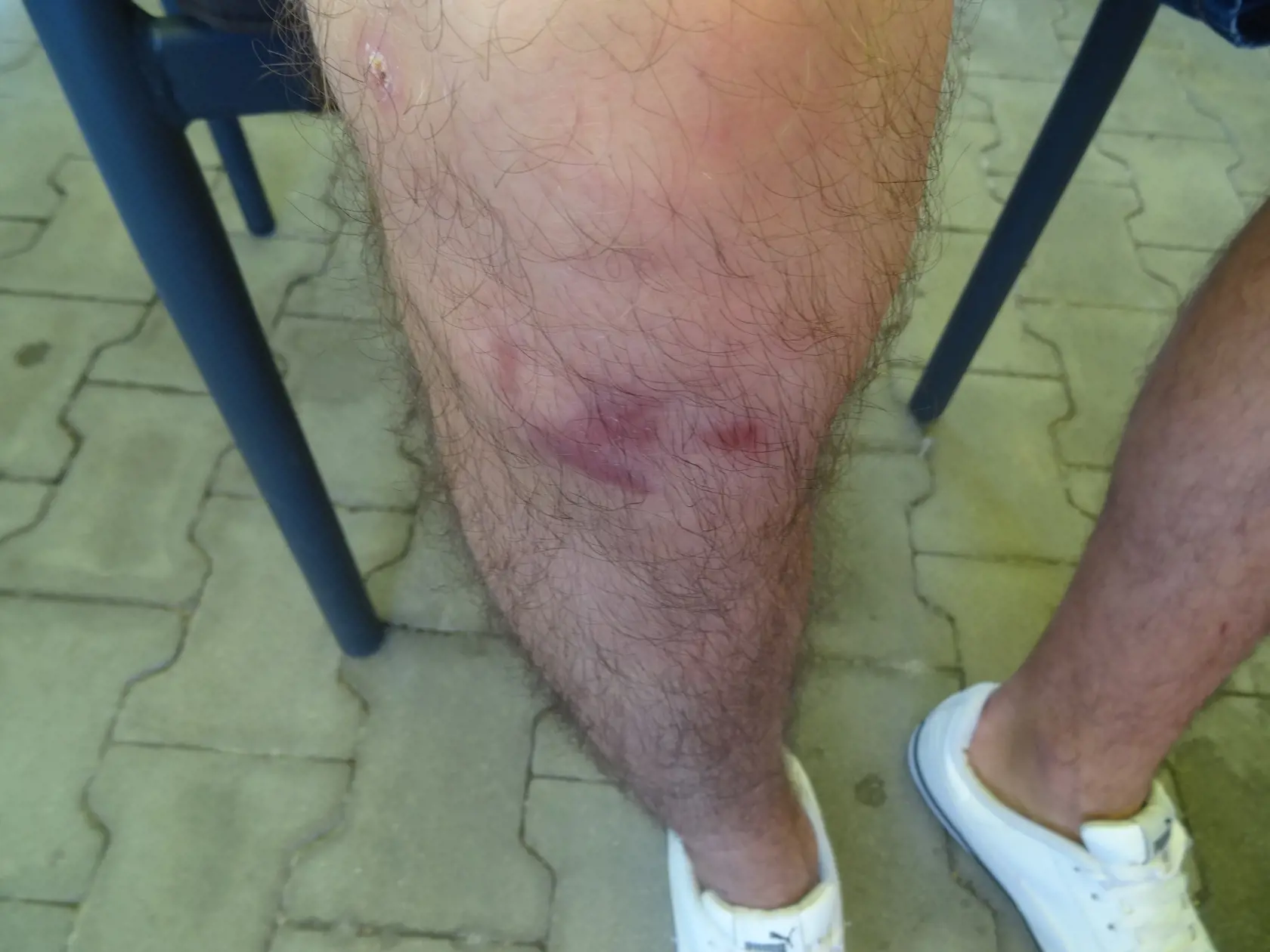 Učiteľ má aj po viac než dvoch týždňoch stále  doráňané obidve nohy.