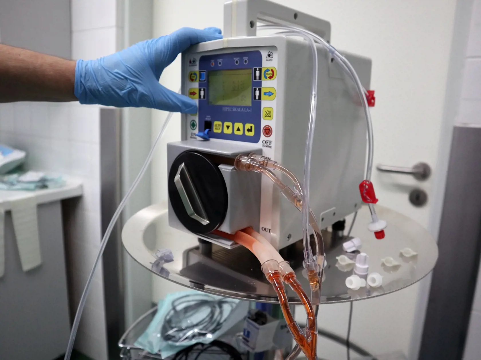 Na snímke realizácia unikátneho operačného výkonu, ktorý realizuje chirurgické oddelenie Fakultnej nemocnice s poliklinikou v Žiline ako jediné špecializované pracovisko na Slovensku metódou s názvom HIPEC. V Žiline, 1. decembra 2022. FOTO TASR - Erika Ďurčová                               