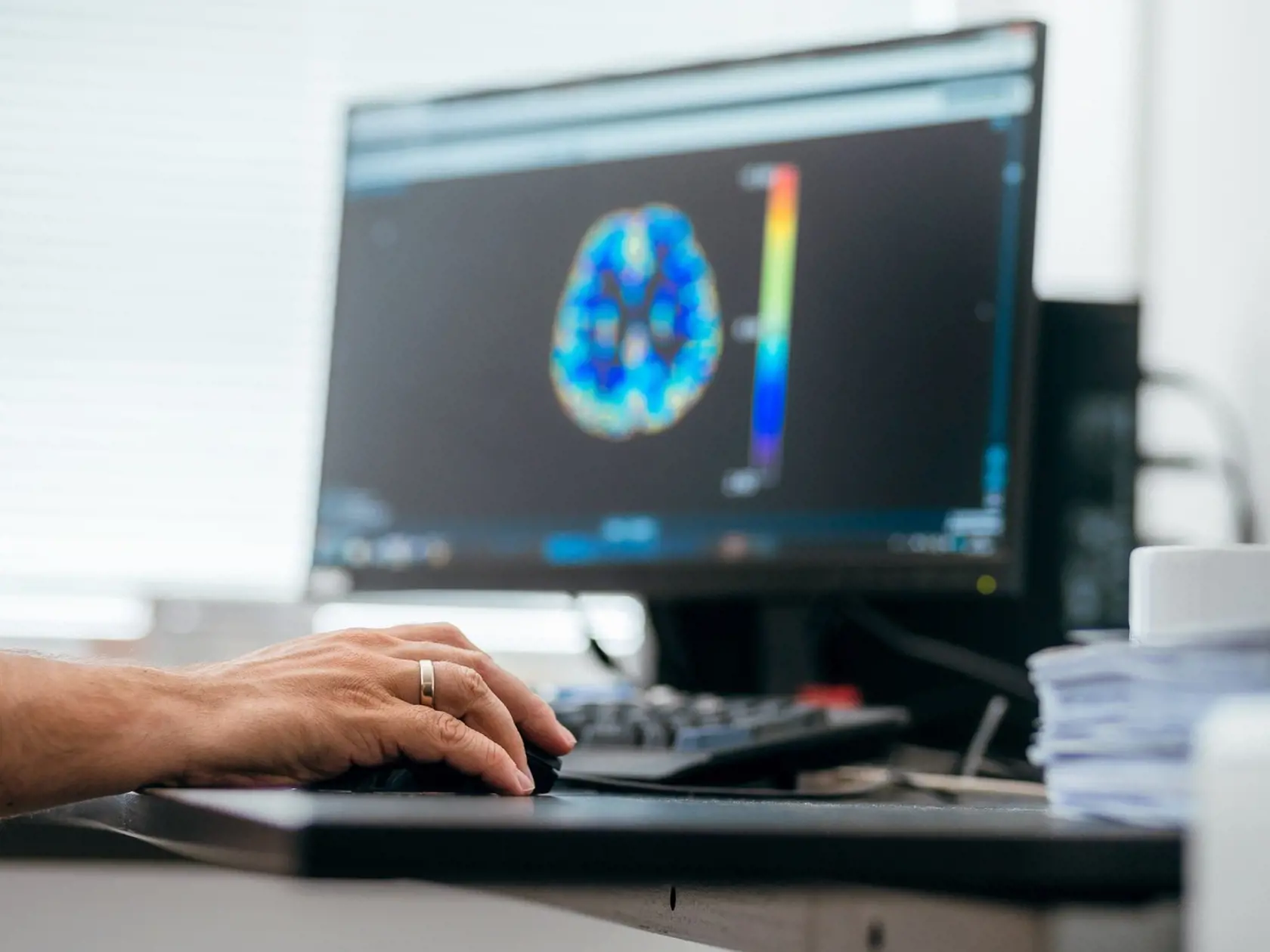Hoci softvér lekára nenahrádza, poskytuje mu veľmi dôležitý druhý názor a informácie navyše, ktoré dokážu byť pri diagnostike veľmi nápomocné a pomáhajú lekárovi rýchlejšie sa rozhodnúť.
