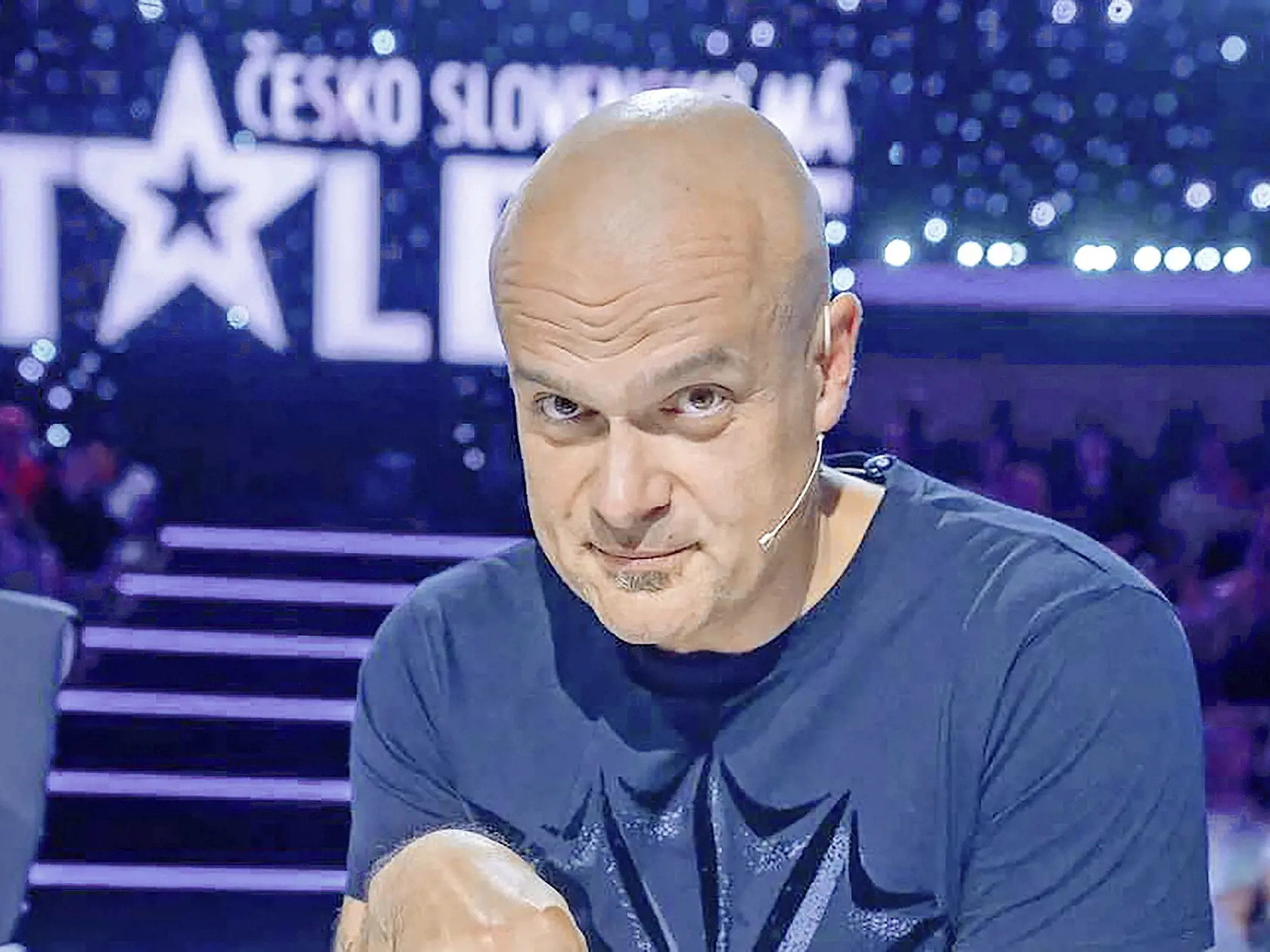 Koniec kolena. Na obraze sme ho roky videli vystrihaného takmer dohola. Zo zadnej časti hlavy mu vzali cibuľky vlasov a transplantovali na jej prednú časť.