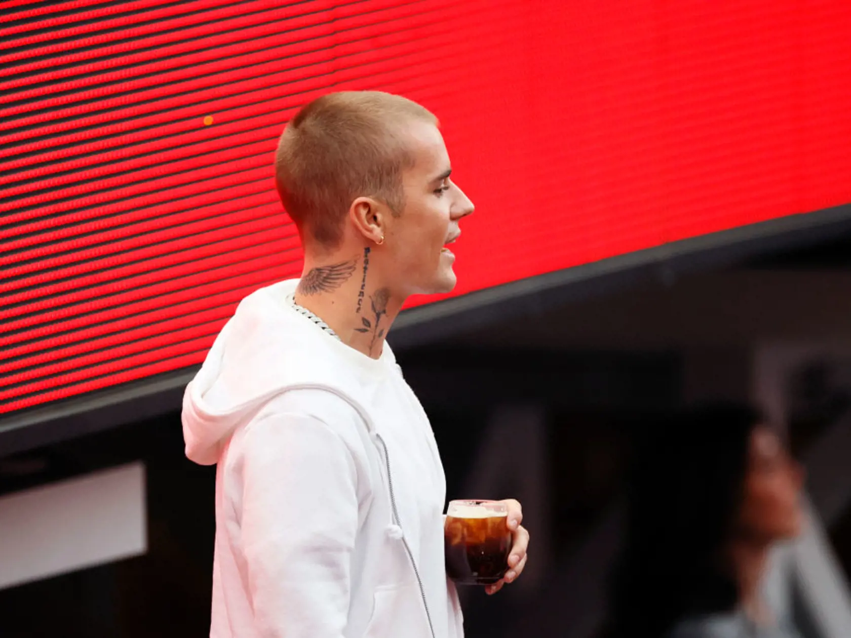 Plastický chirurg Dr. Gary Linkov naznačil, že spevák Justin Bieber podstúpil transplantáciu vlasov. Na starých fotkách mu totiž vidieť „kúty“.