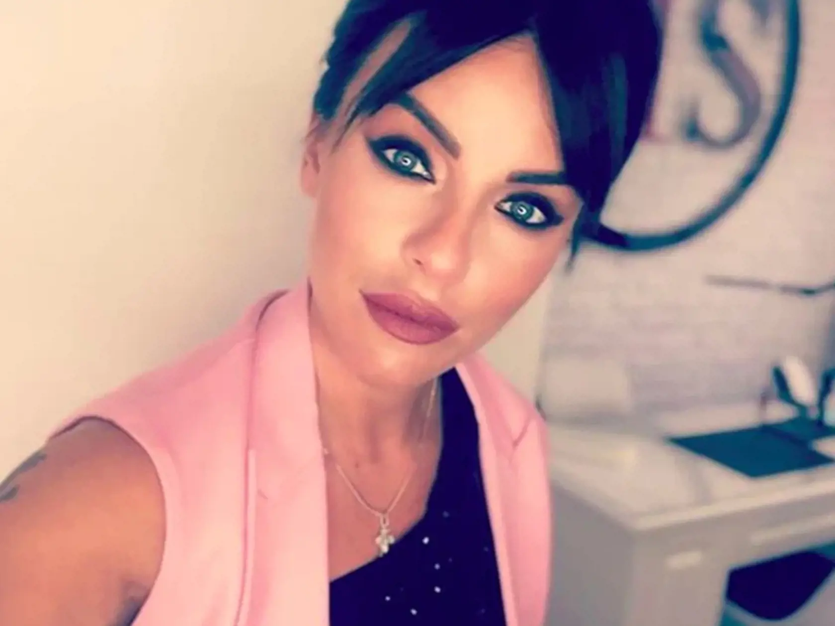 Julia Volkova vyzerá kvôli plastickým operáciám na nepoznanie.
