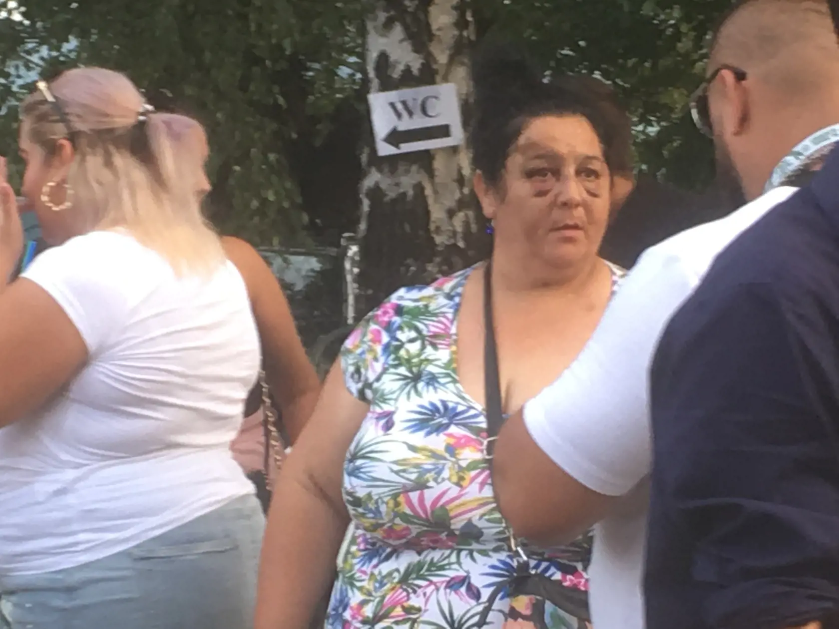 Janka Sendreiová mala po ťažkej havárii napriek zraneniam dobrú náladu a Balvalfest nezrušili.
