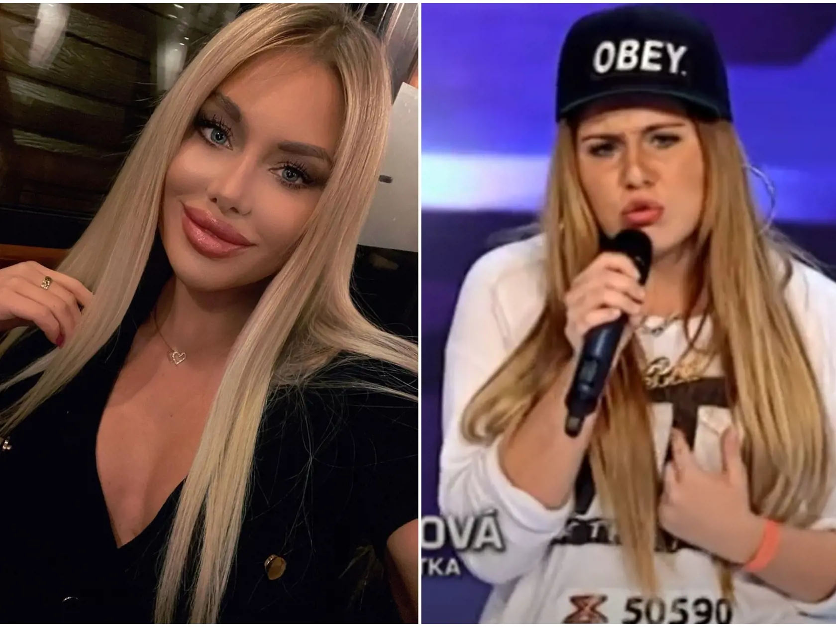 Atraktívna blondína za posledné roky extrémne zmenila imidž. Zbavila sa nadváhy a prešla aj viacerými estetickými vylepšeniami. Je viac než isté, že si dala zväčšiť pery, absolvovala úpravu pŕs a pravdepodobne aj korekciu nosa.